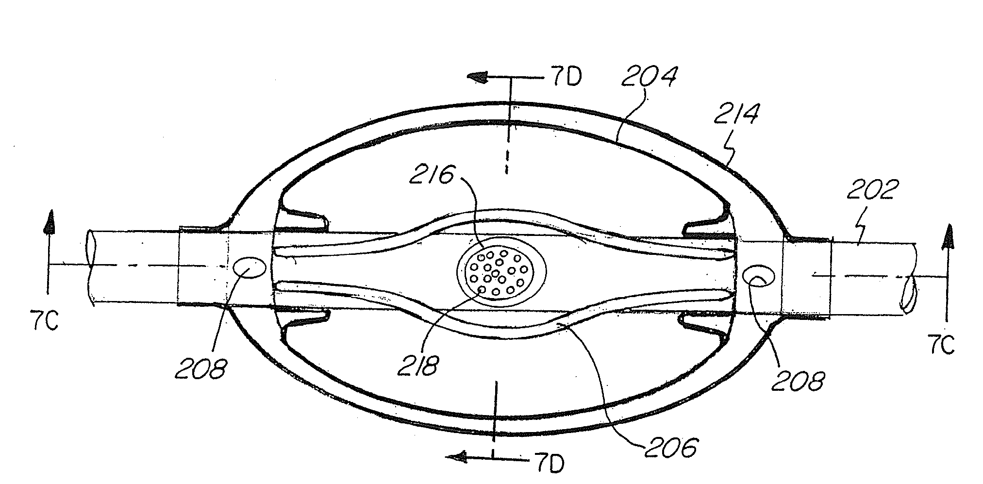 Nasal Delivery of Agents with Nested Balloon Catheter