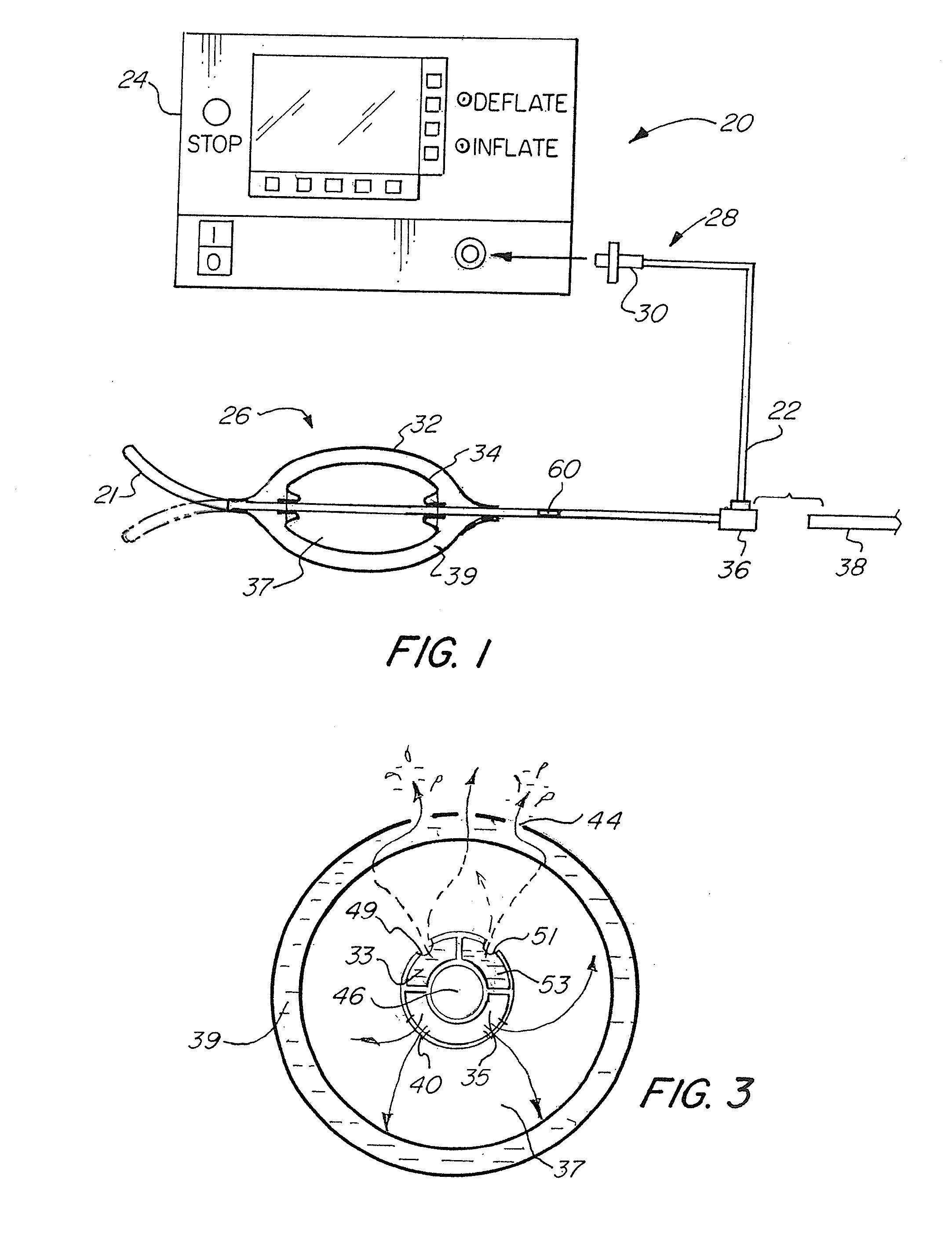 Nasal Delivery of Agents with Nested Balloon Catheter