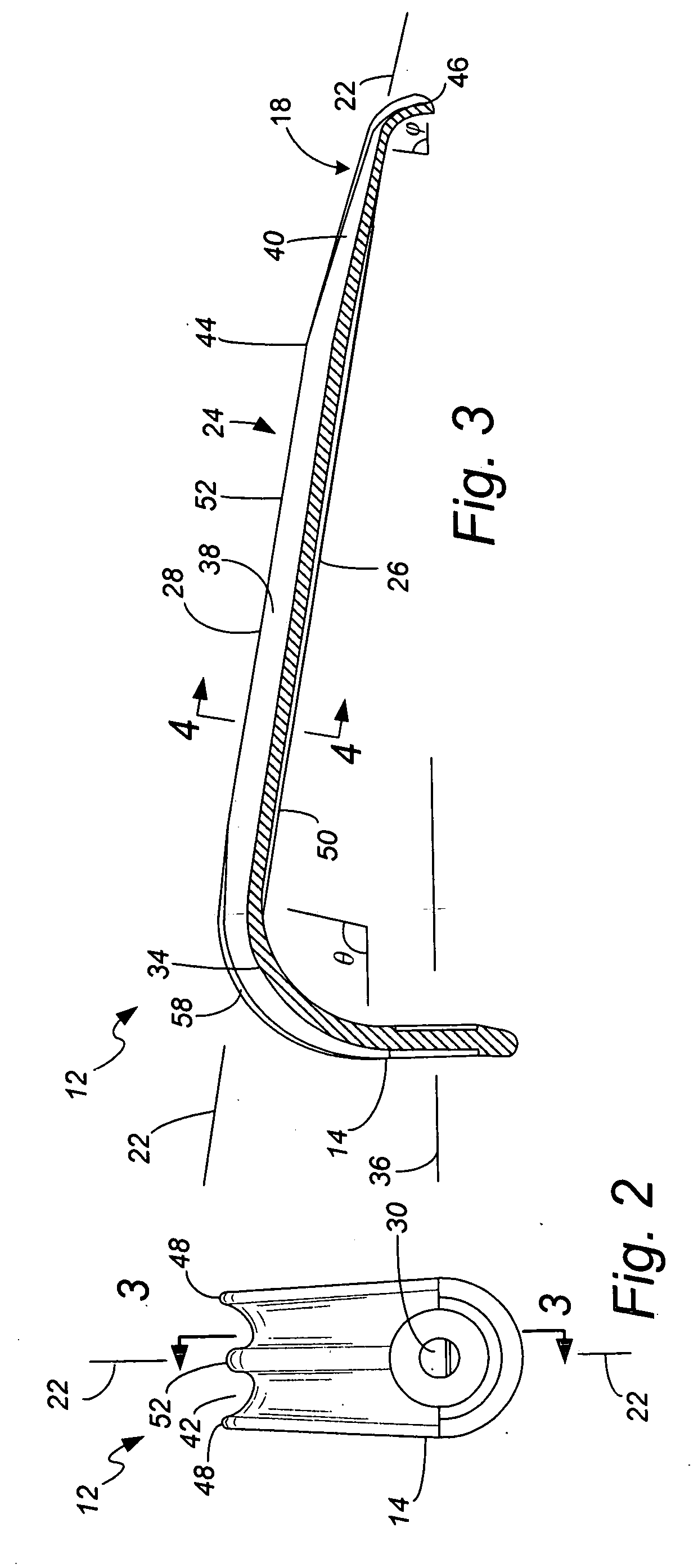 Shaped retractor blade