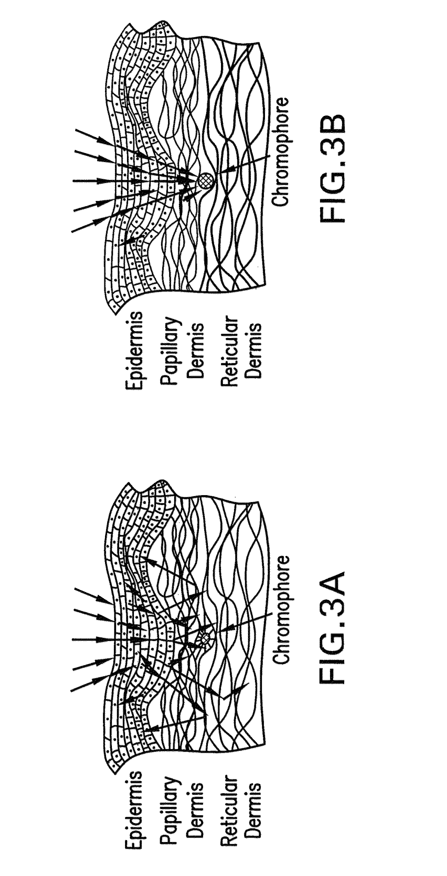 System, devices, and methods for optically clearing tissue