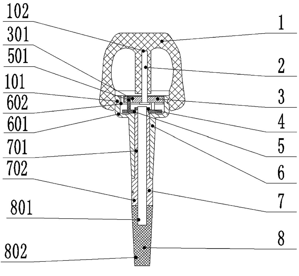 String fine-tuning mechanism based on planetary gear transmission with small tooth difference