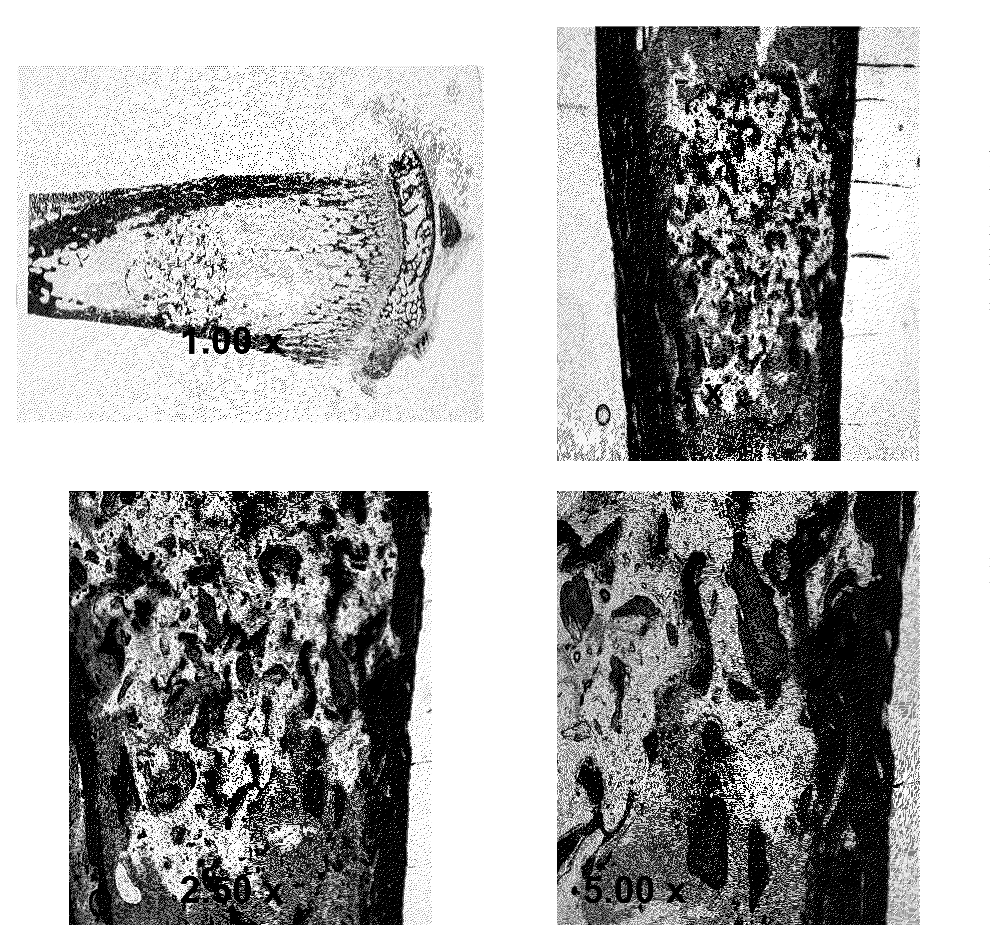 Injectable bone/polymer composite bone void fillers