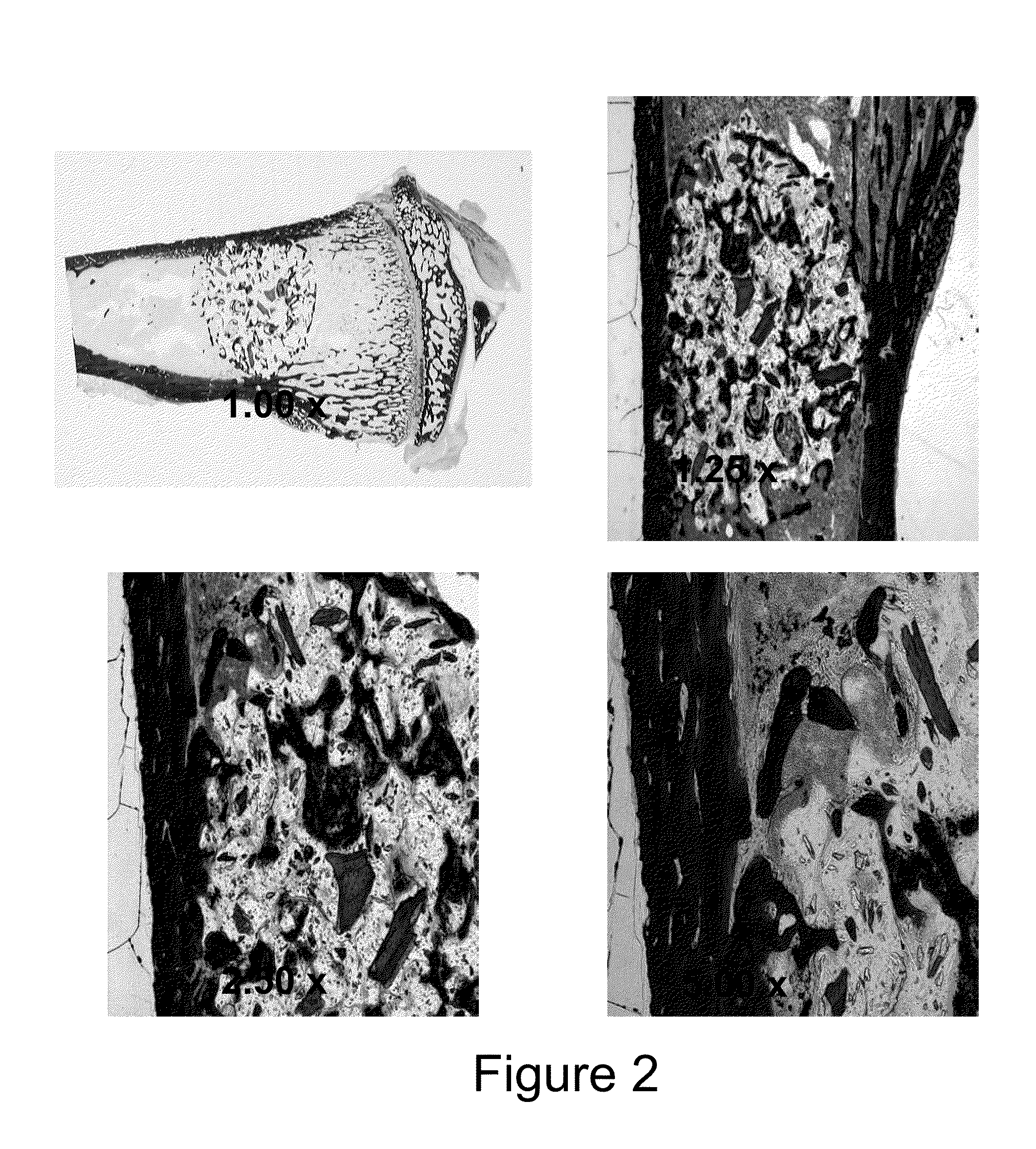 Injectable bone/polymer composite bone void fillers