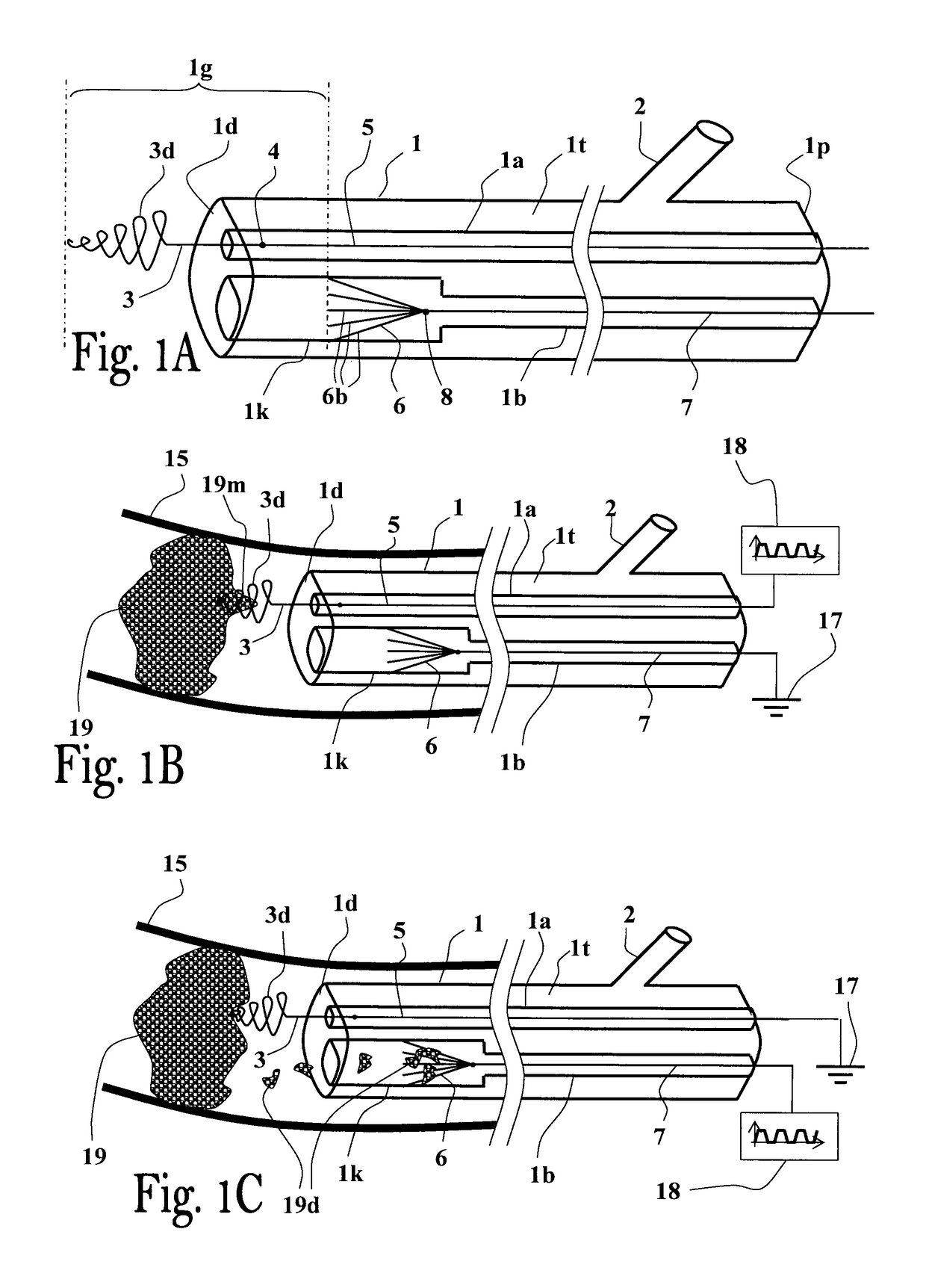 Method and apparatus for thrombus dissolution/thrombectomy by an electrode catheter device