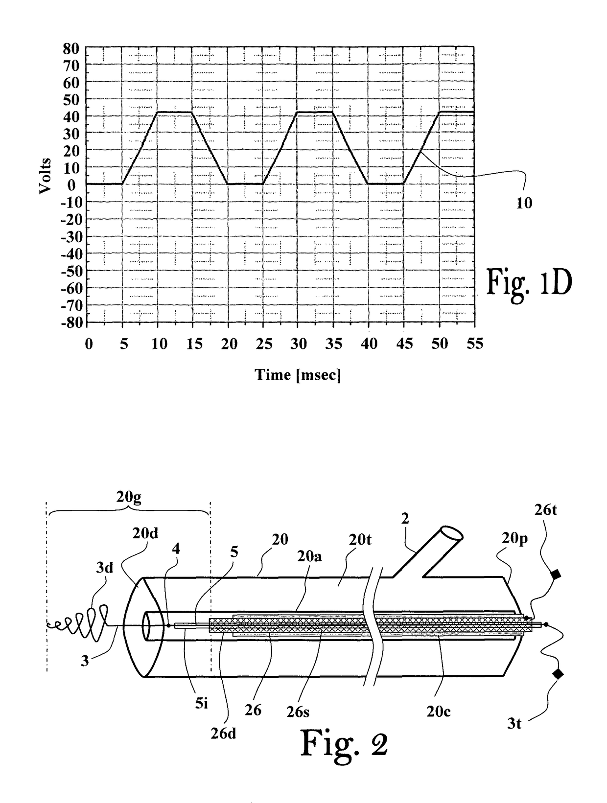 Method and apparatus for thrombus dissolution/thrombectomy by an electrode catheter device