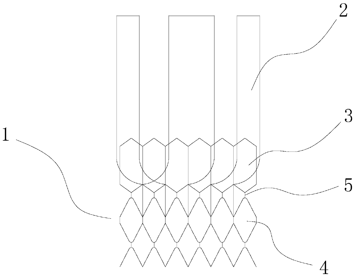 Transcatheter implanted aortic valve stent