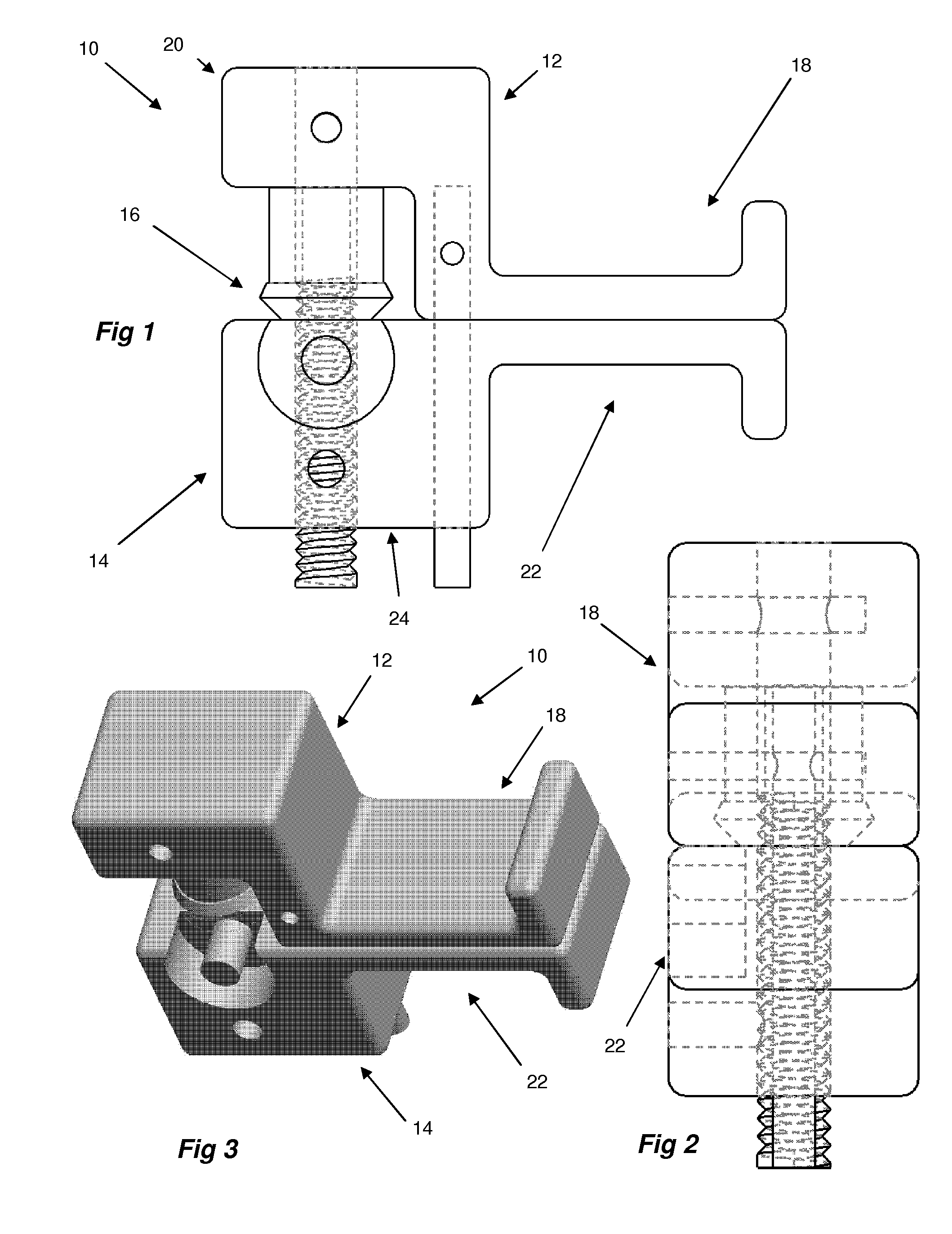 Spinal decompression system