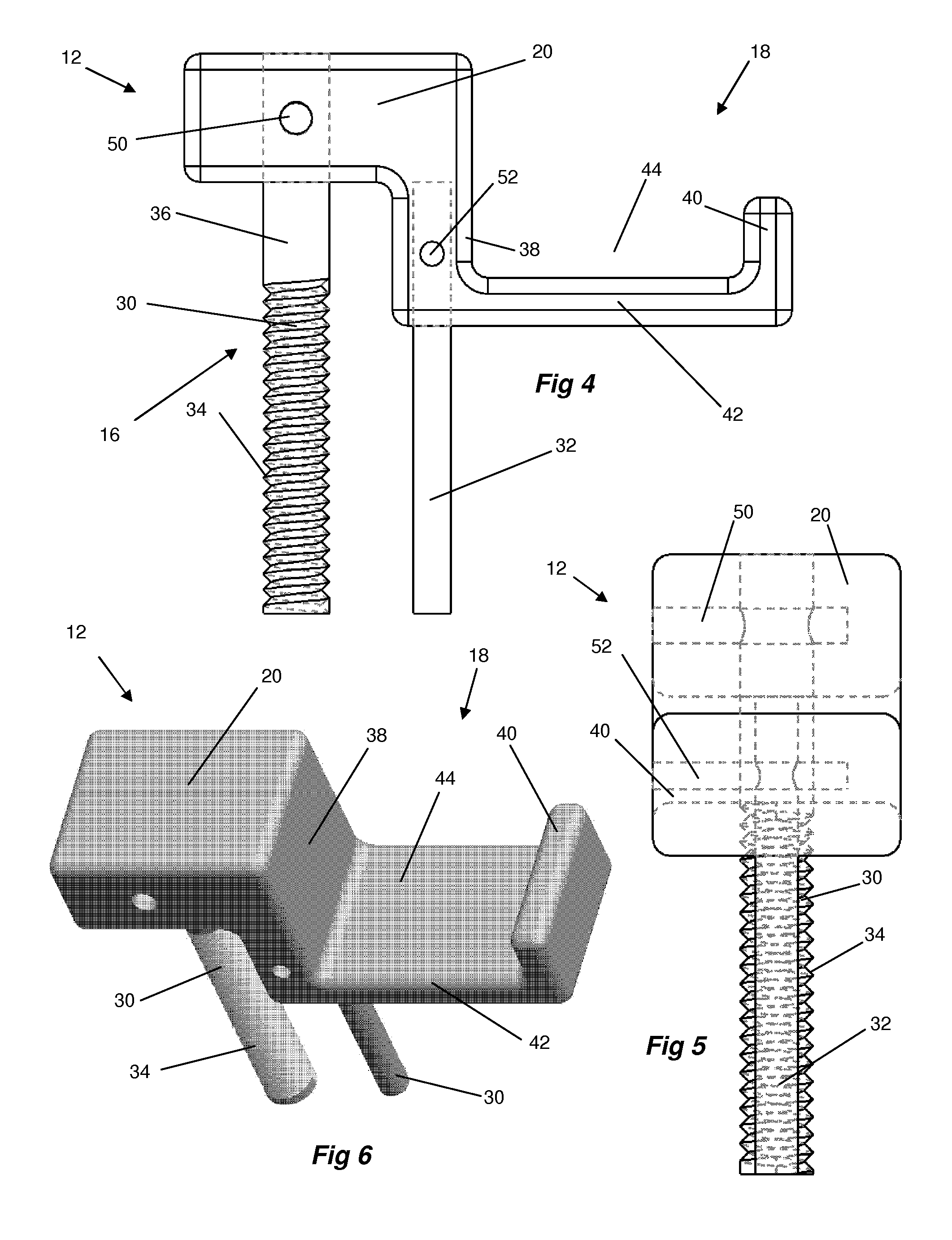 Spinal decompression system