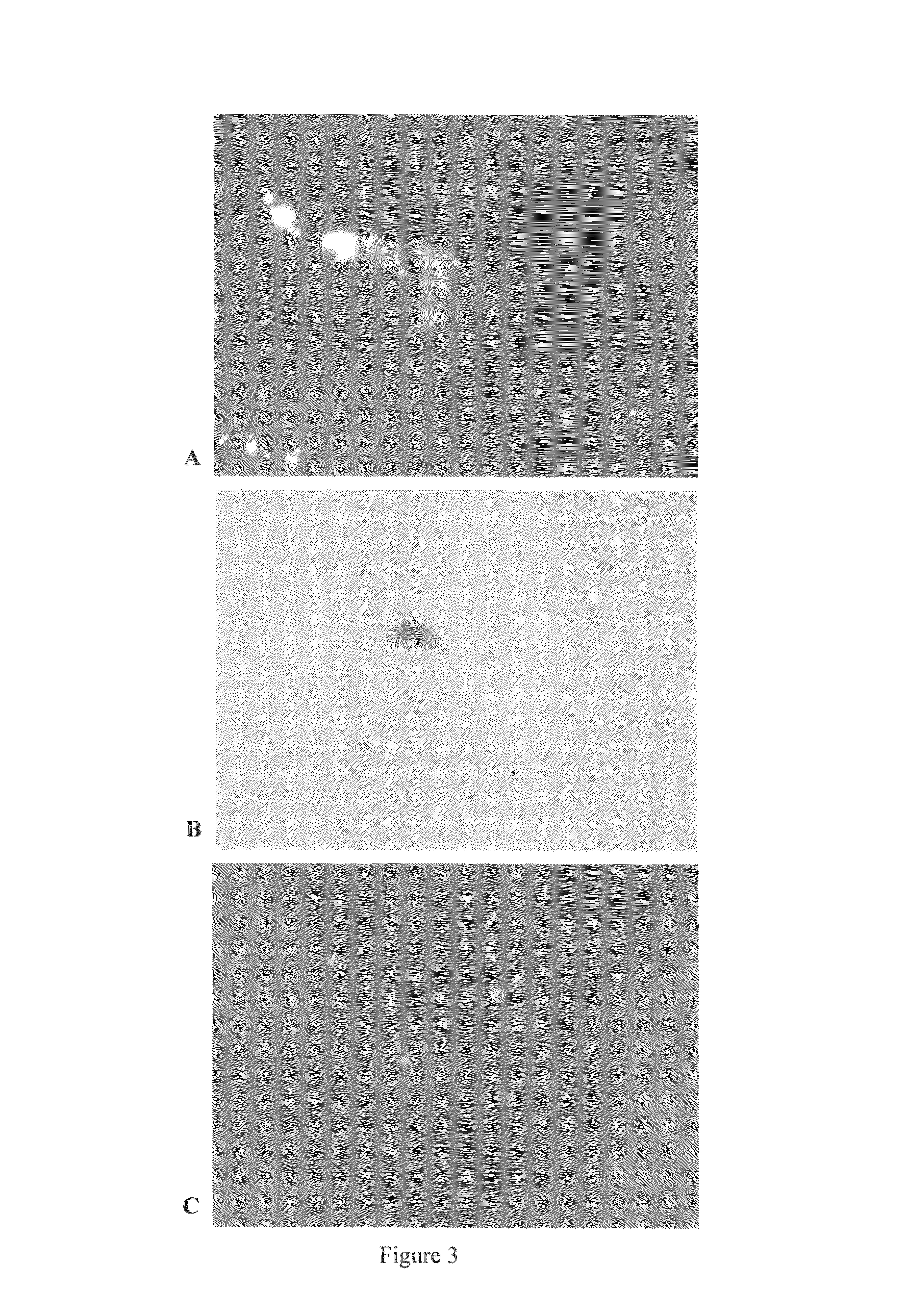 Compositions and methods for culturing spirochetes