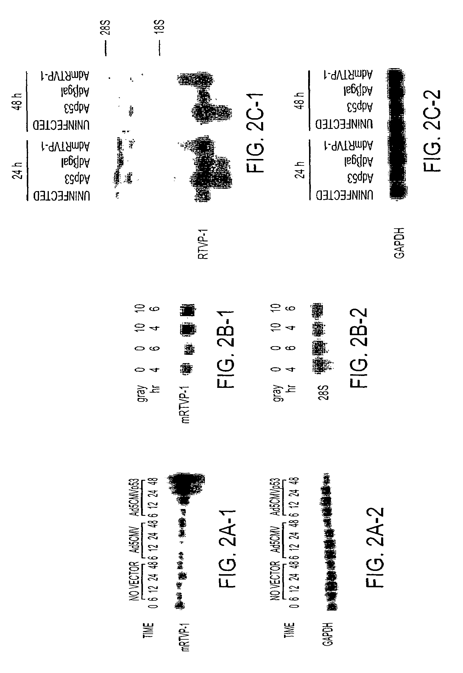 RTVP based compositions and methods for the treatment of prostate cancer