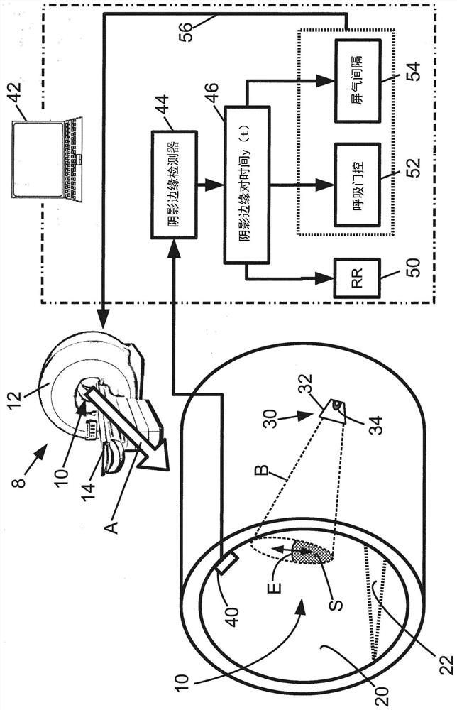 Detection and measurement of respiration using optical cameras and projected shadows