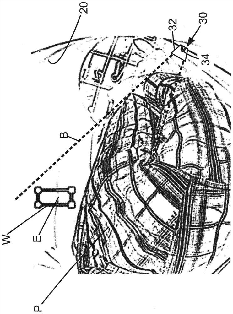 Detection and measurement of respiration using optical cameras and projected shadows