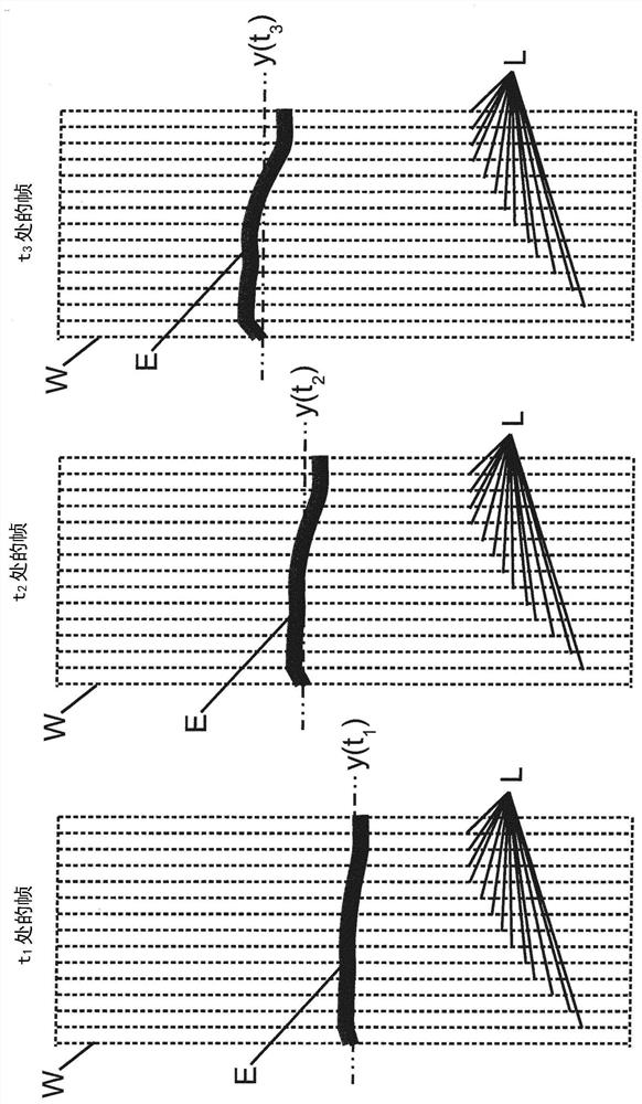 Detection and measurement of respiration using optical cameras and projected shadows