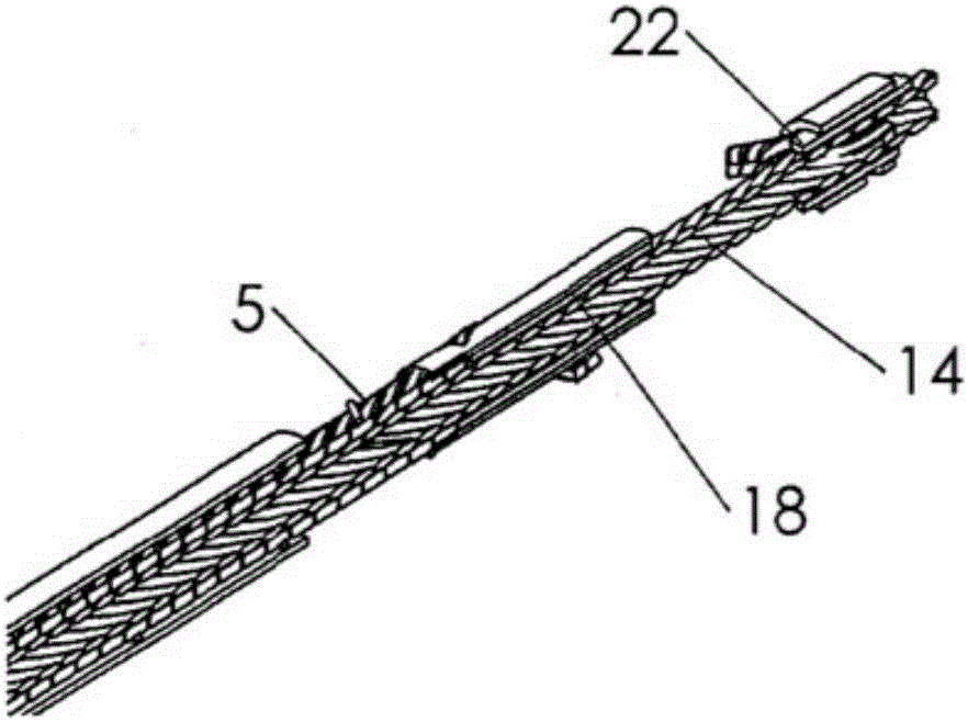 Improved atherectomy device