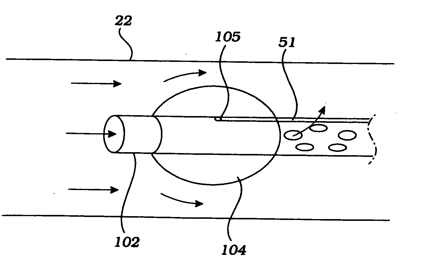 Cerebral perfusion augmentation