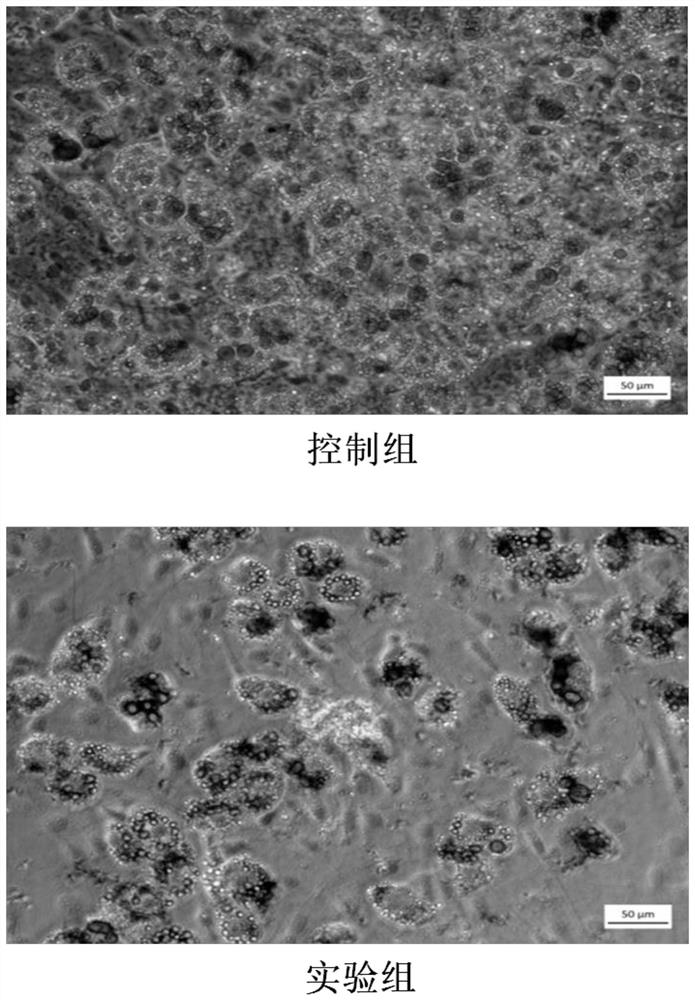 Application of cyclocarya paliurus extract in increasing fat-reducing gene expression quantity, increasing basal metabolic rate and/or inhibiting fat accumulation