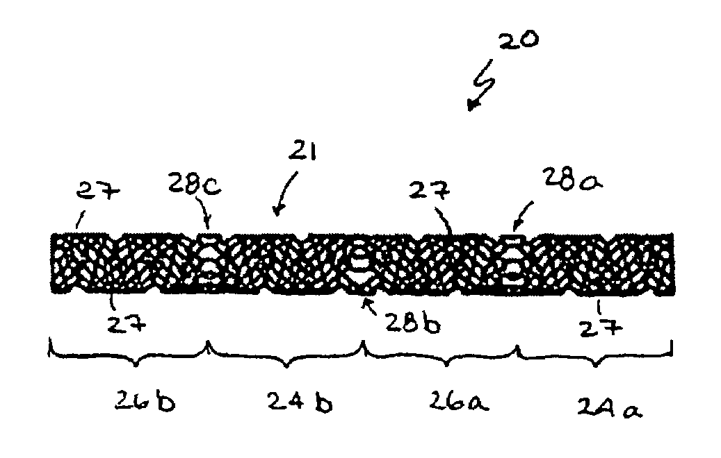 Vascular prosthesis with alternating helical sections