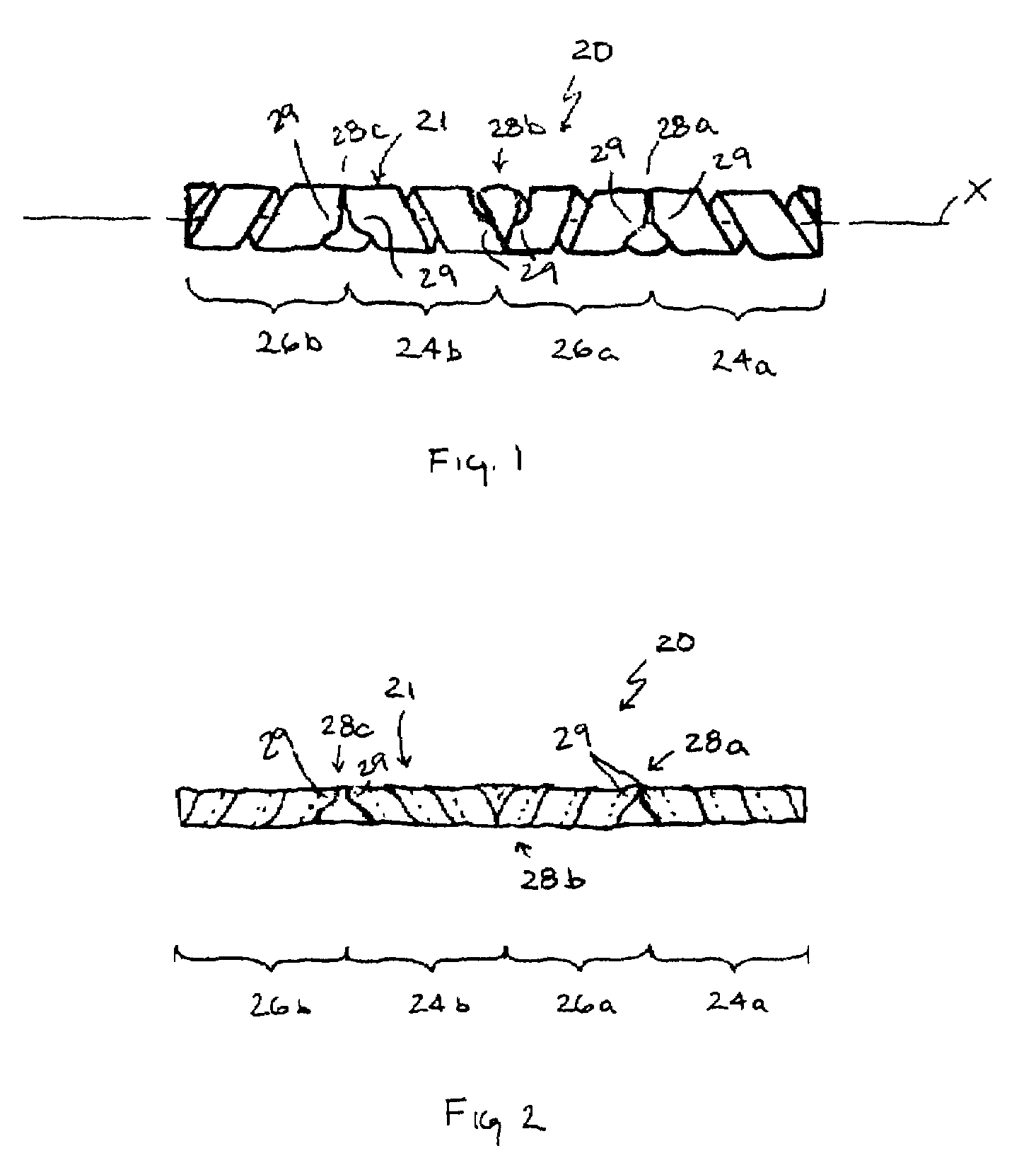 Vascular prosthesis with alternating helical sections