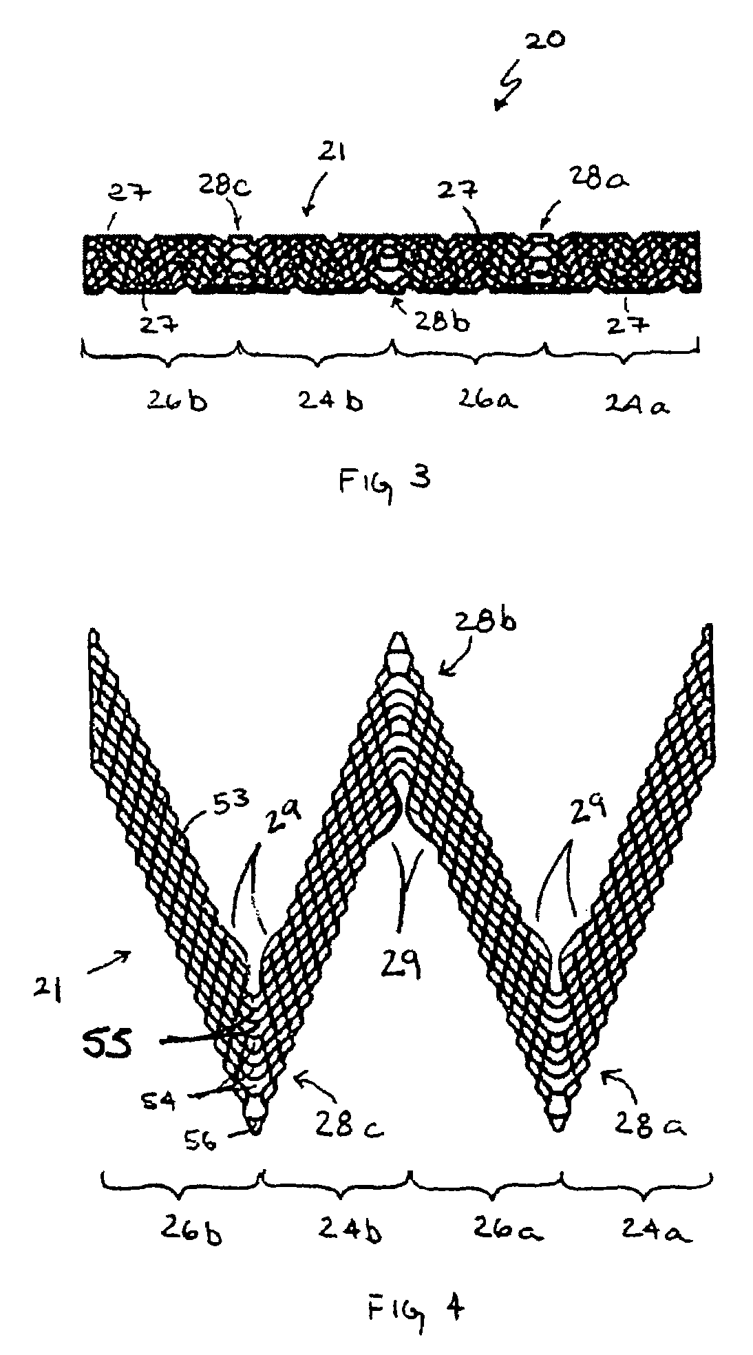 Vascular prosthesis with alternating helical sections