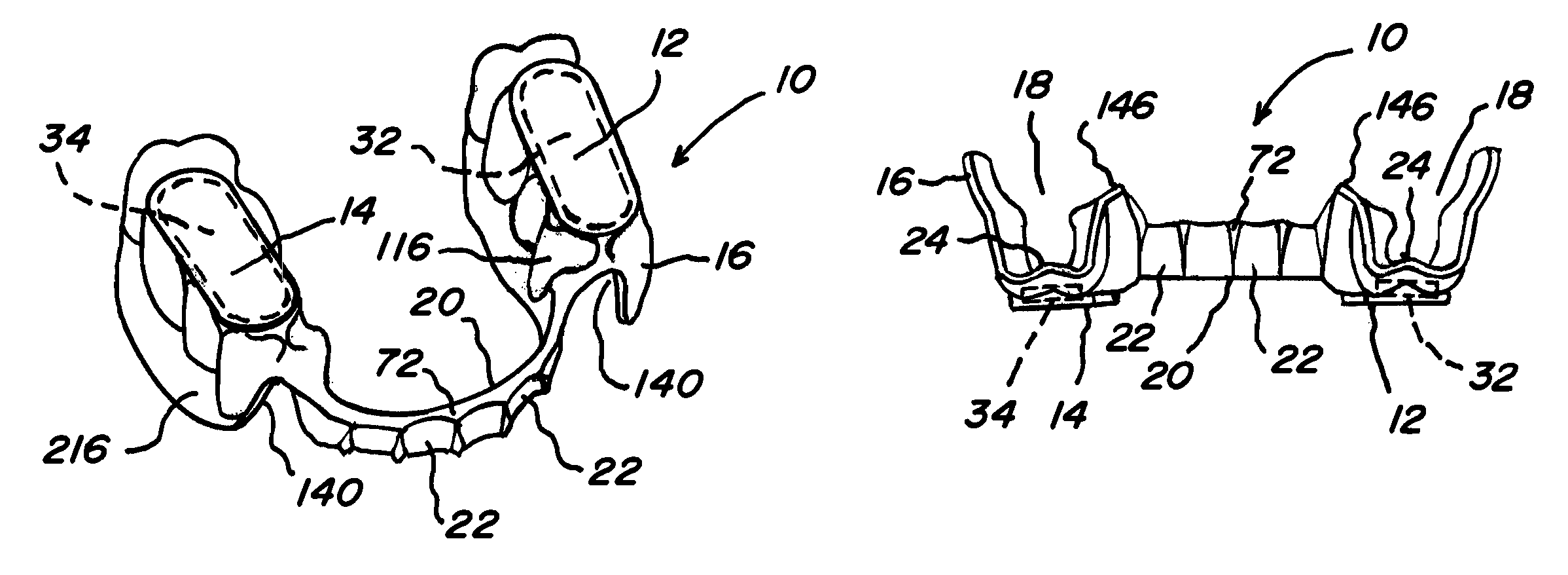 Composite oral appliances and methods for manufacture