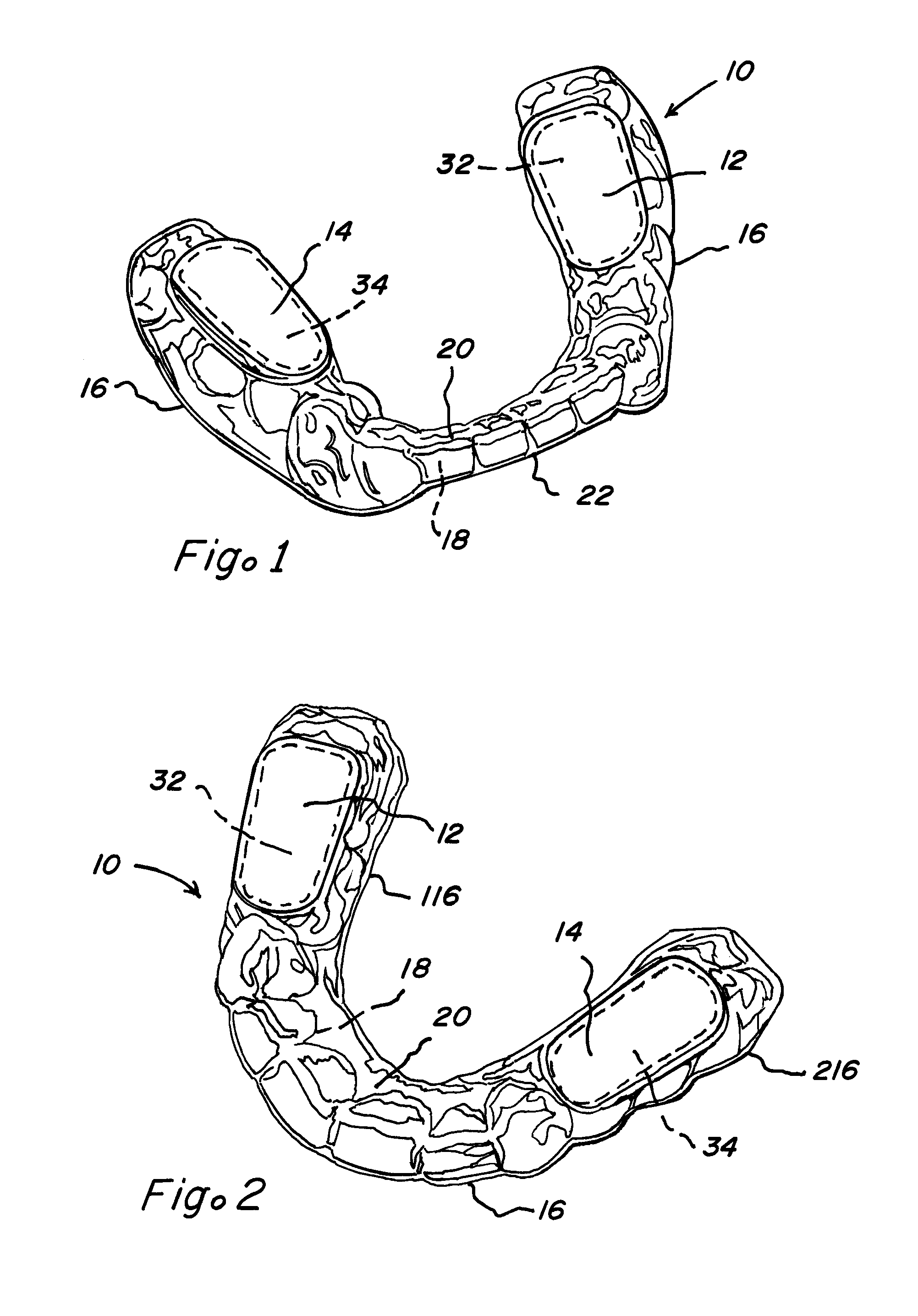 Composite oral appliances and methods for manufacture