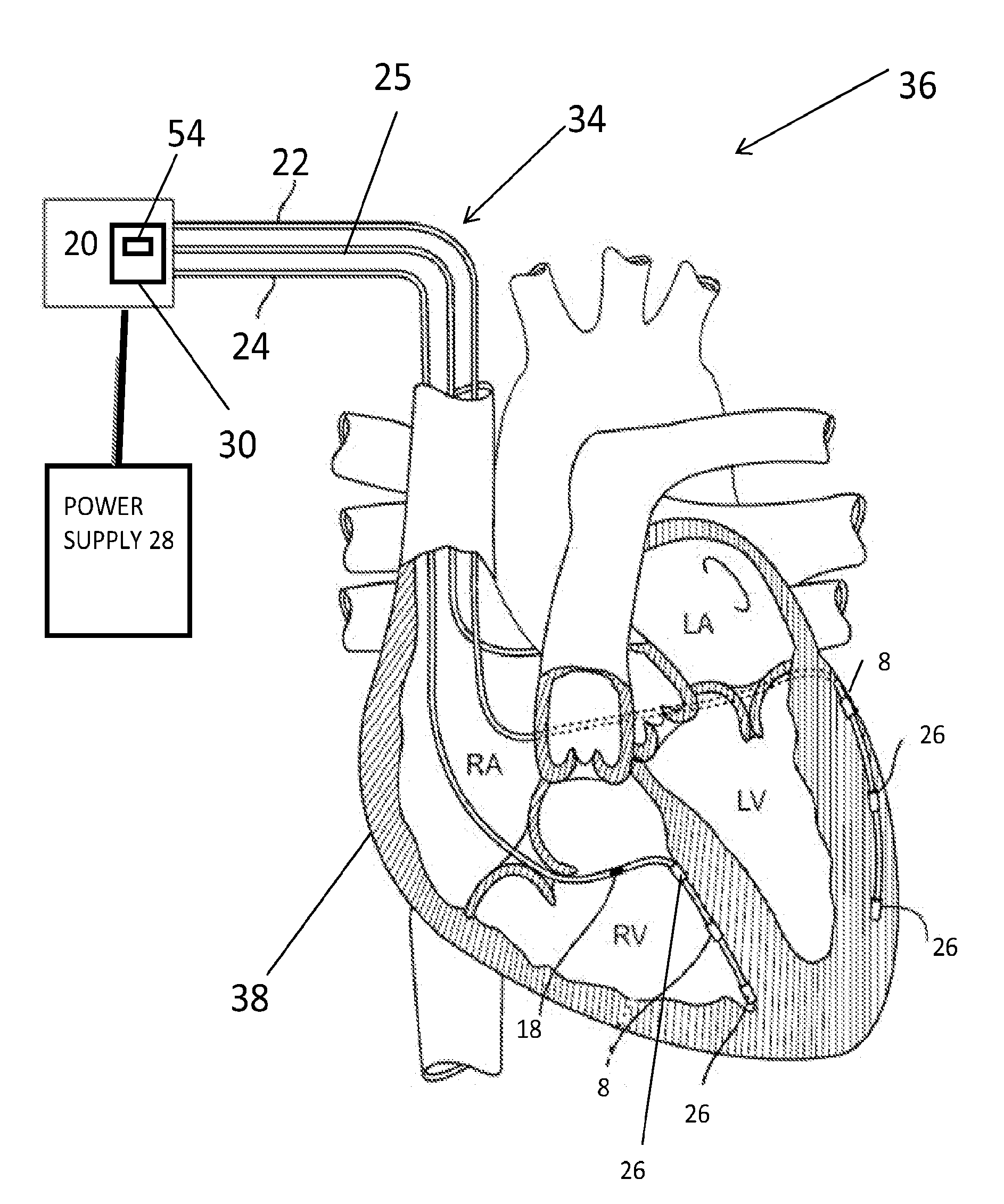 Integrated Circuit Implementation and Fault Control System, Device, and Method