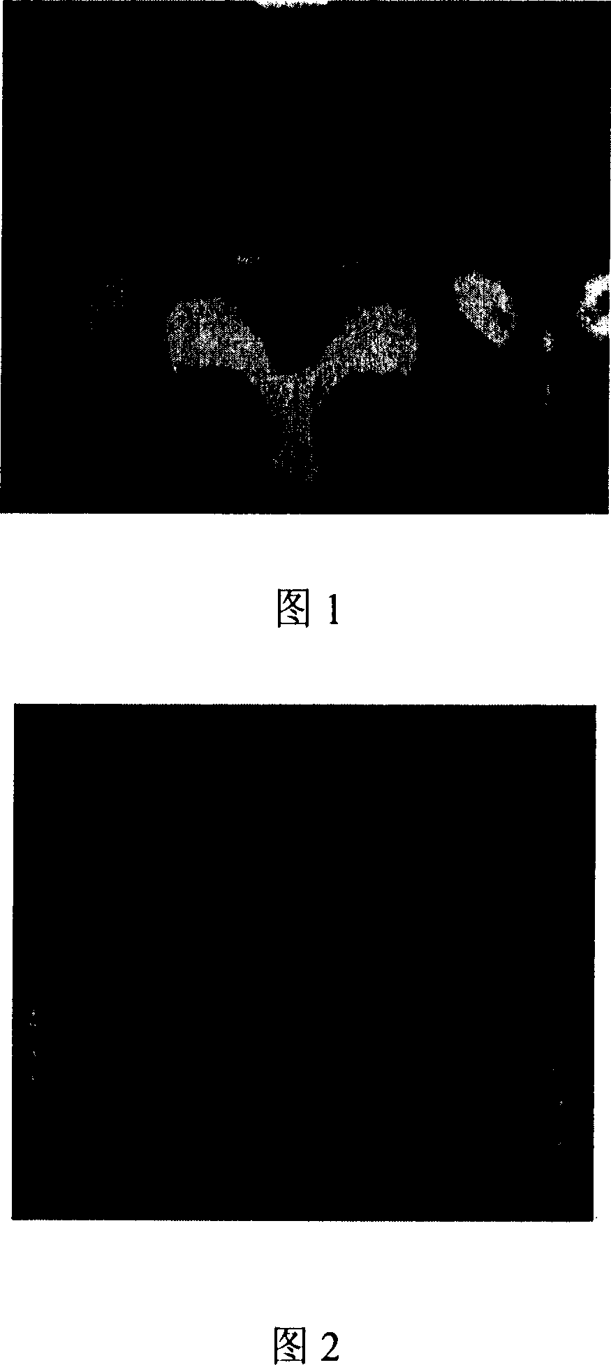 Medicinal composition for treating spondyle disease and method for preparing the same