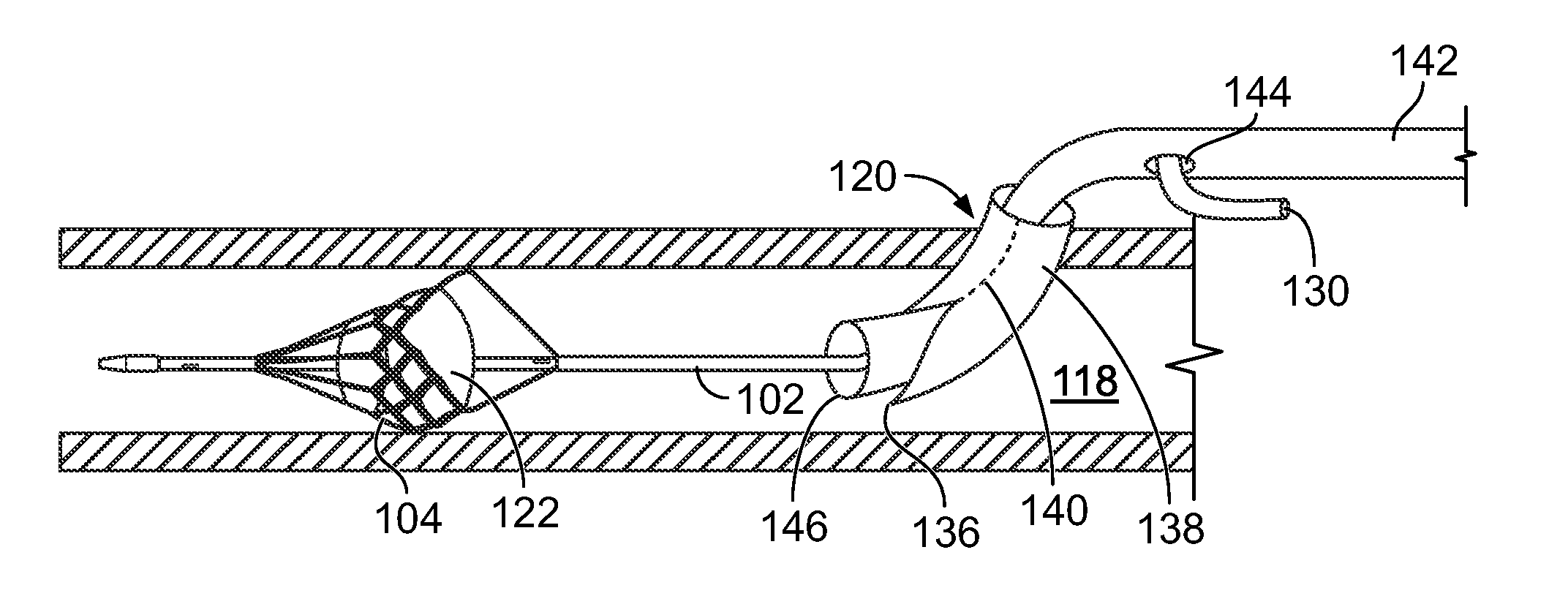 Temporary filter retrieval apparatus and method