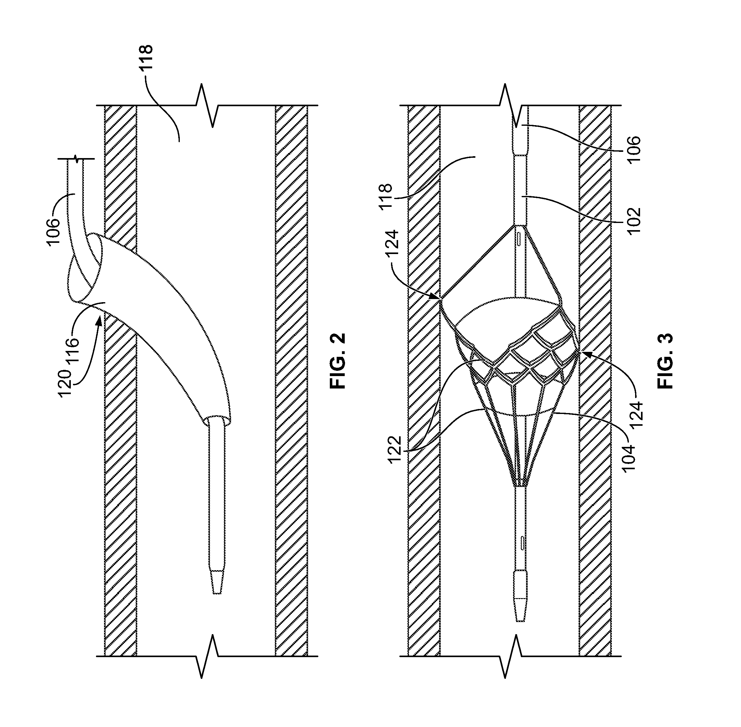 Temporary filter retrieval apparatus and method