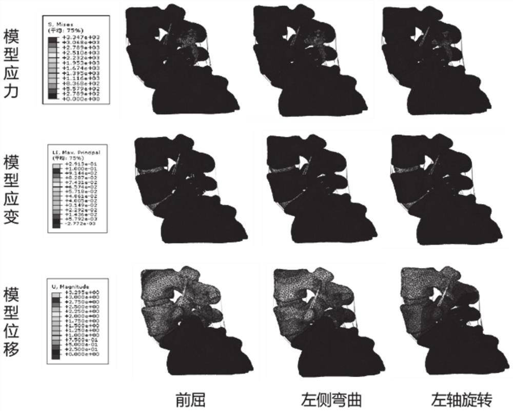 Simulation method and system of lumbar spondylolysis screw vertebral plate hook internal fixation system