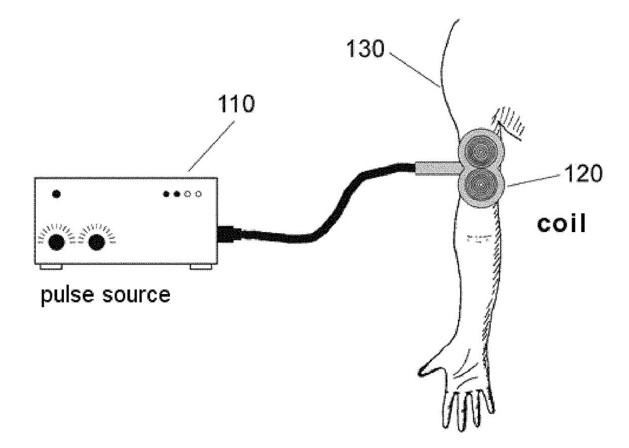 Magnetic stimulation having a freely selectable pulse shape