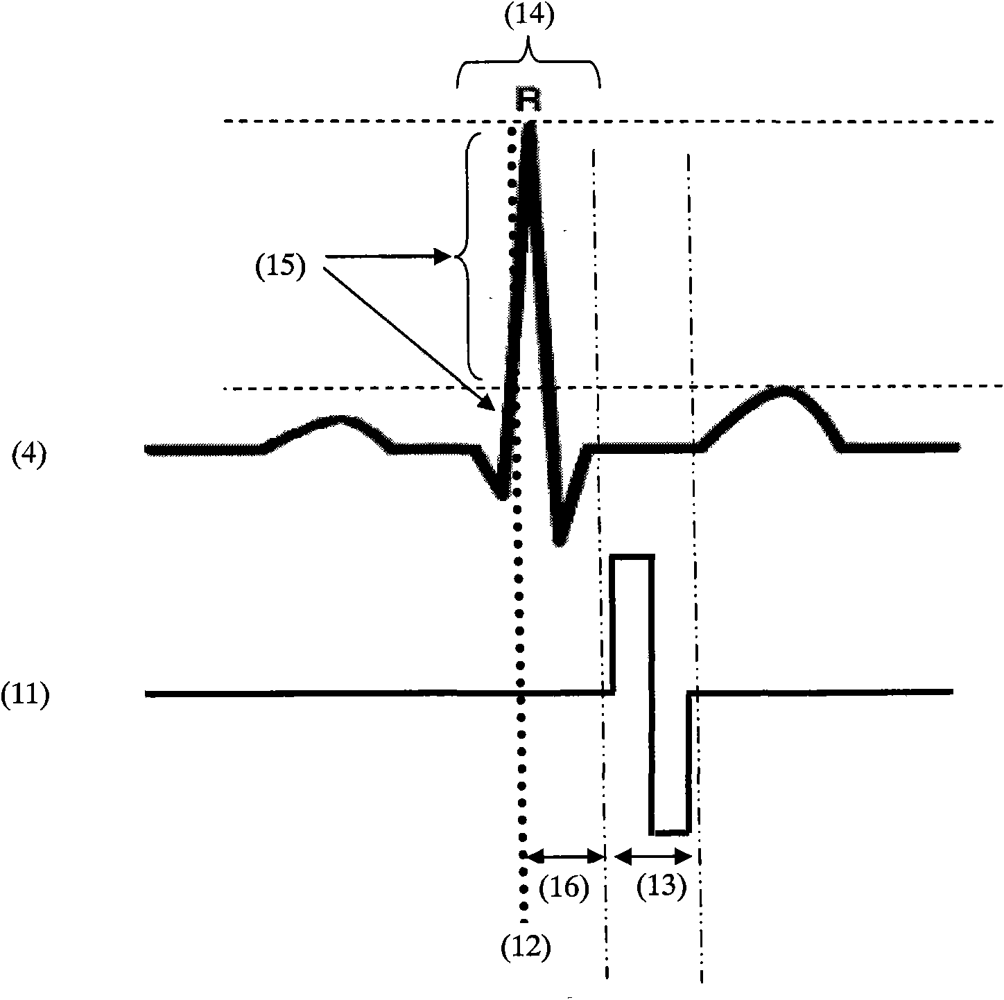 In-vitro percutaneous cardiac contractile force regulation