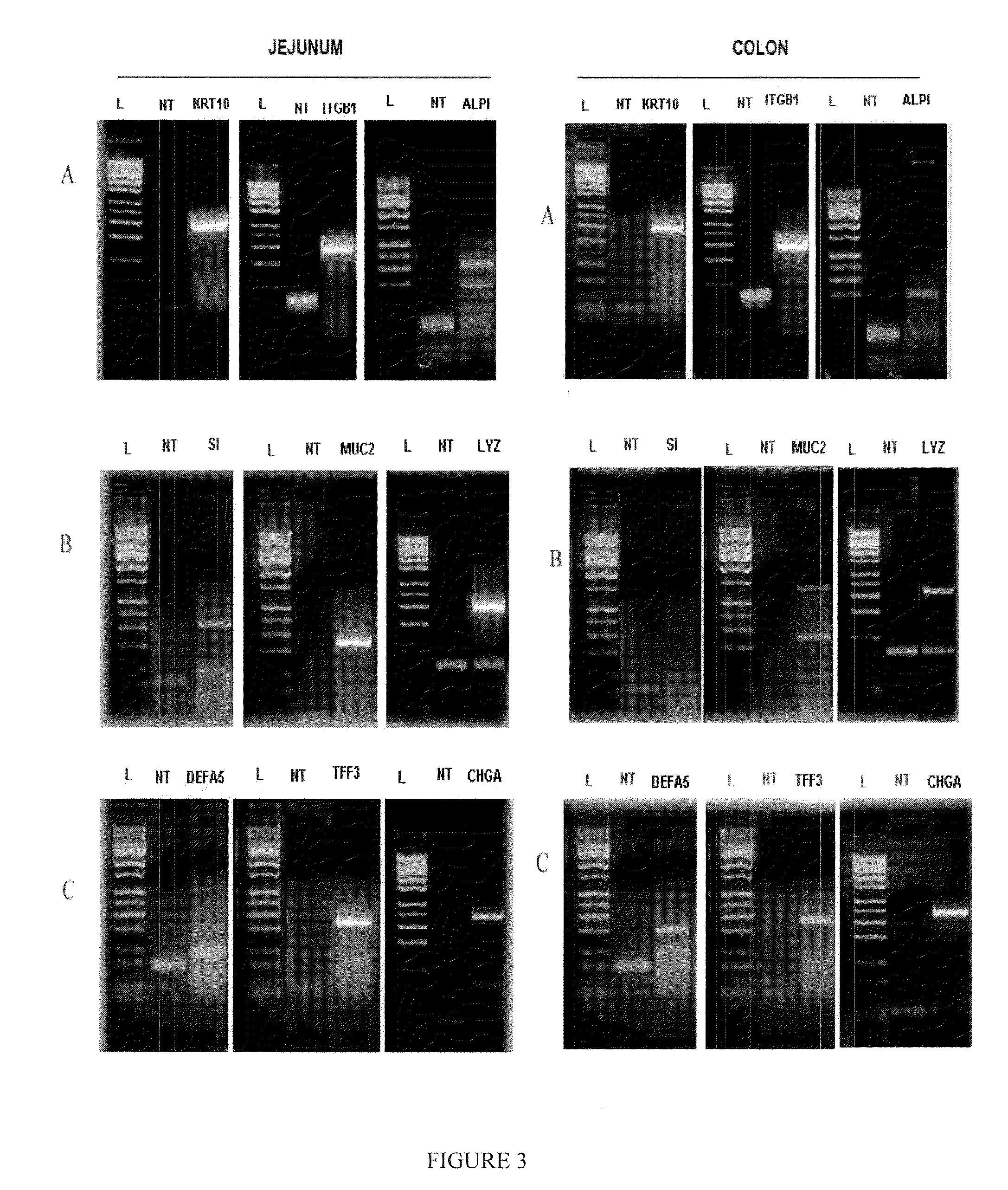 Drug Discovery Methods Involving A Preclinical, In Vitro Isolated Gastrointestinal Epithelial Stem Cell-Like Progenitor Cell System