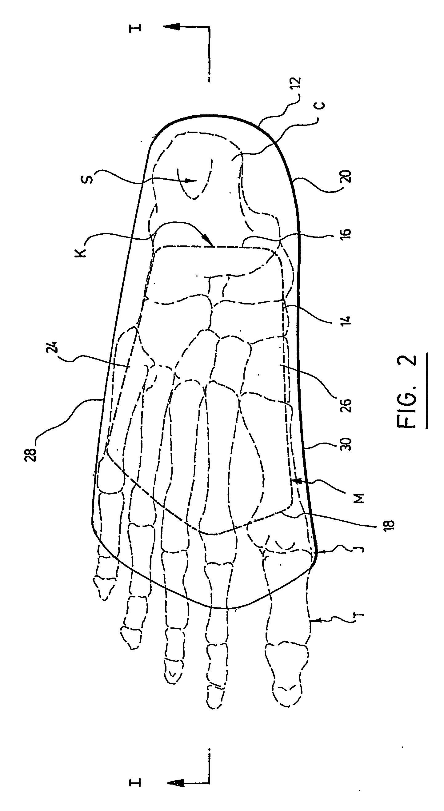 Biomechanical custom made foot orthosis and method for making the same