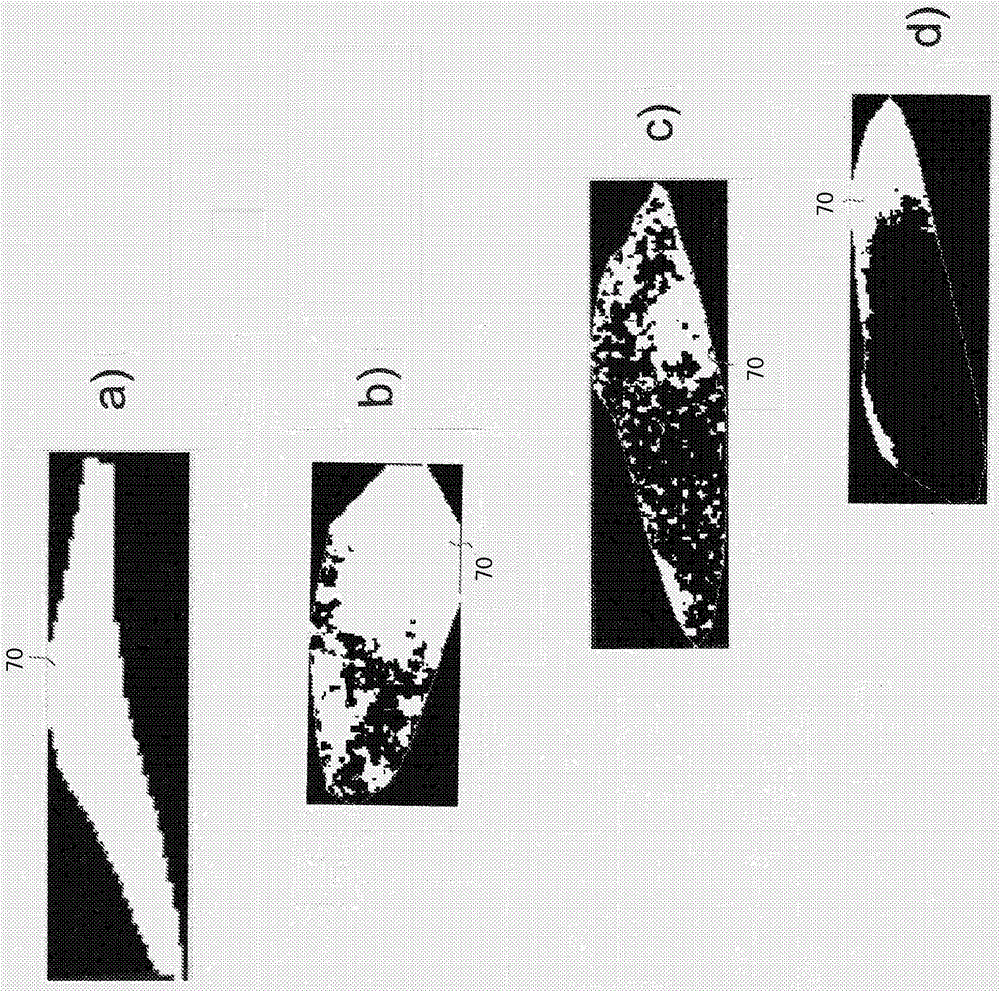 Evaluation of carotid plaque using contrast enhanced ultrasonic imaging