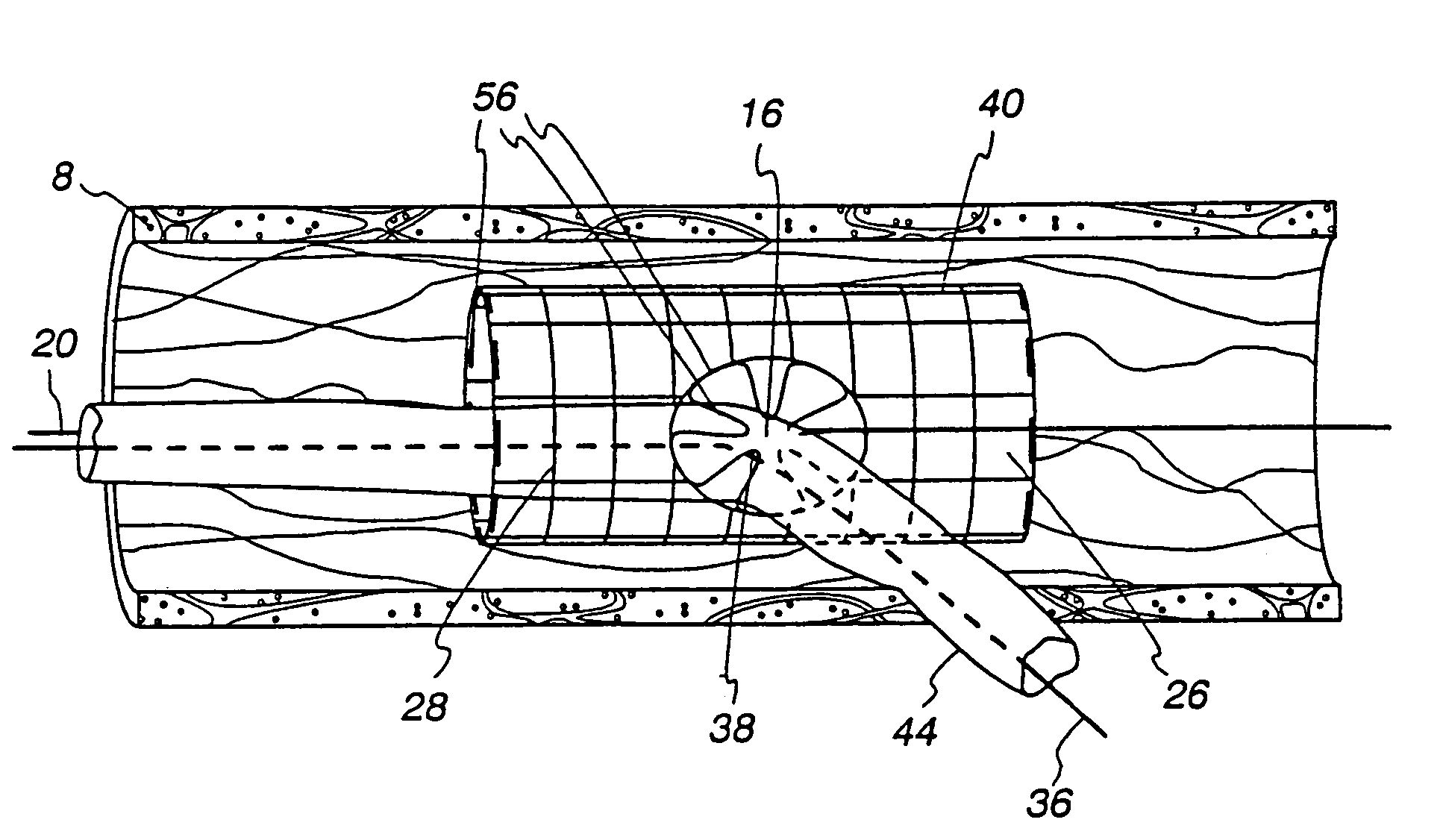 Extendible stent apparatus