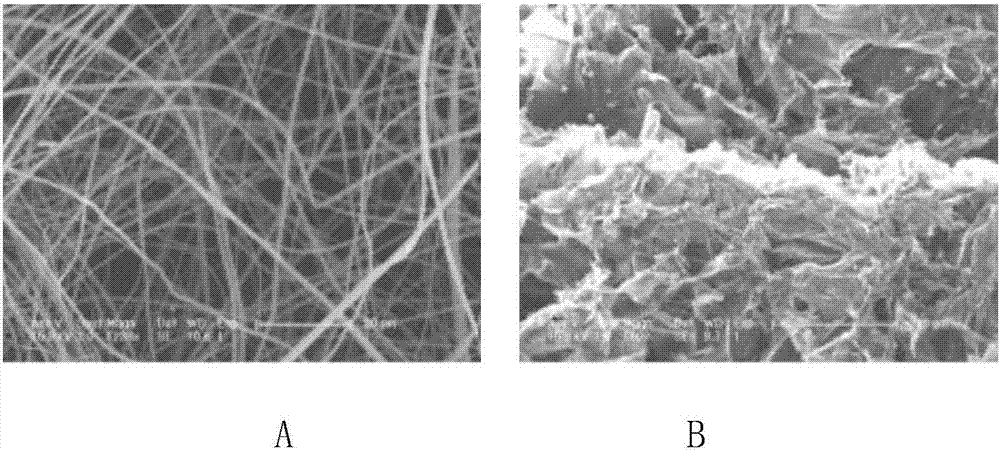 Hemostatic sponge/drug-loaded fiber mat/hemostatic sponge compound and preparation method thereof