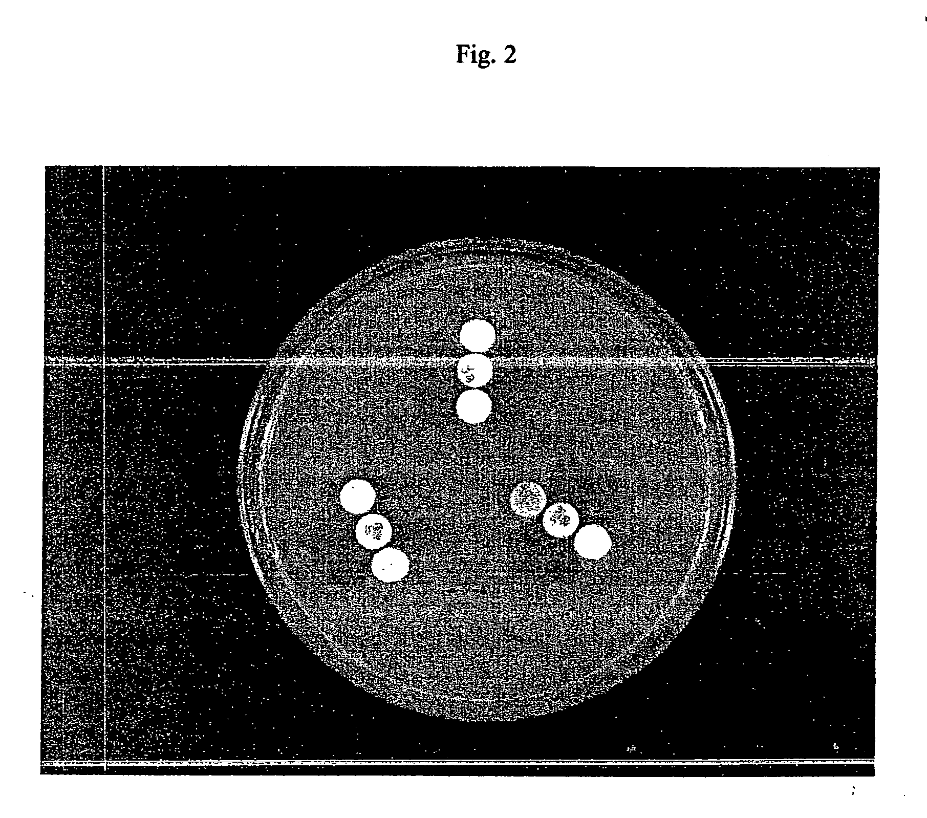 Device and method for detecting antibiotic inactivating enzymes