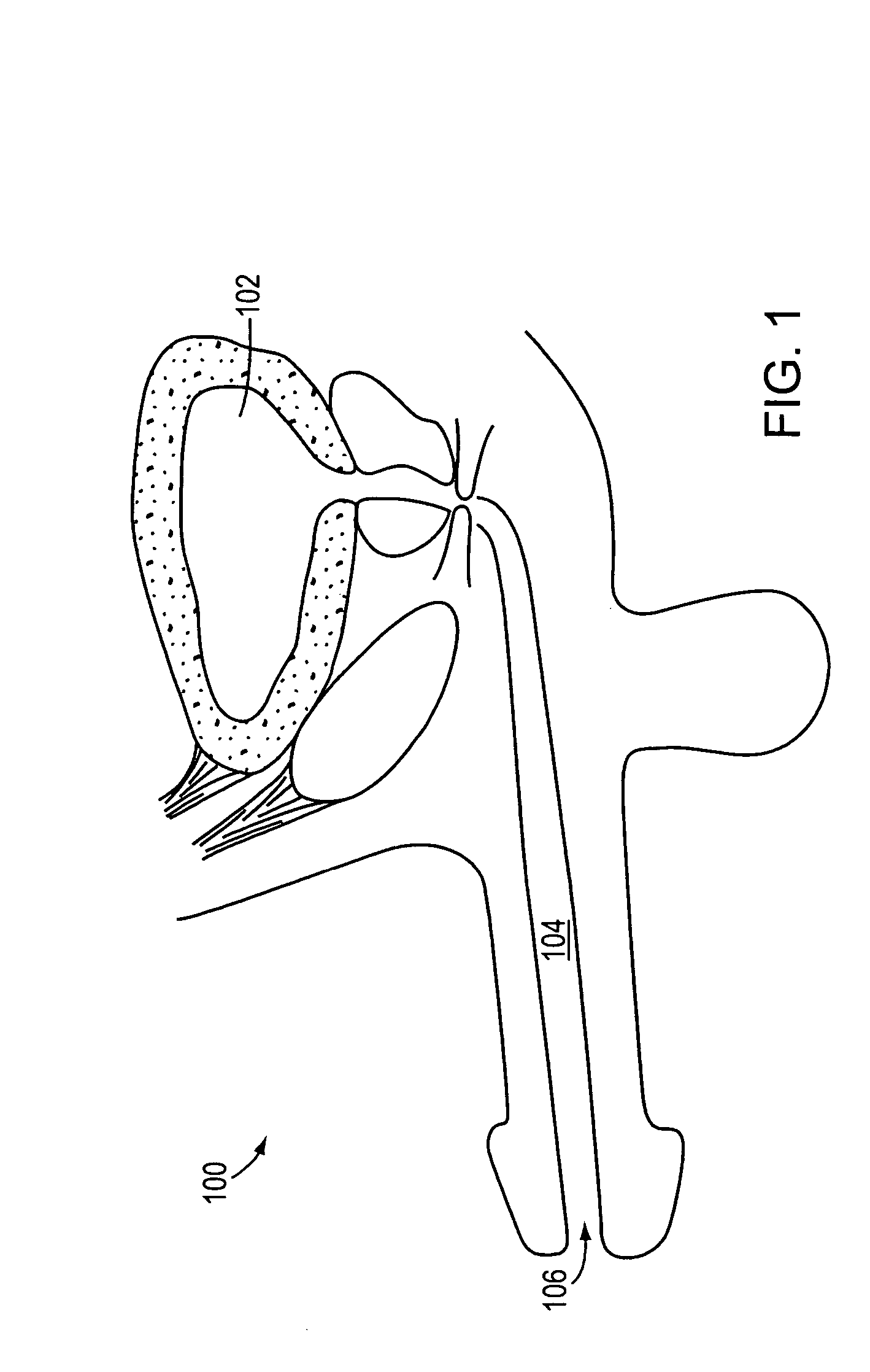 Stricture retractor