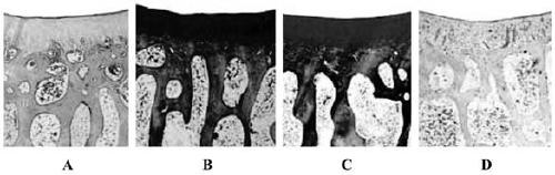 Composite scaffold for hip articular cartilage repair and preparation method of composite scaffold