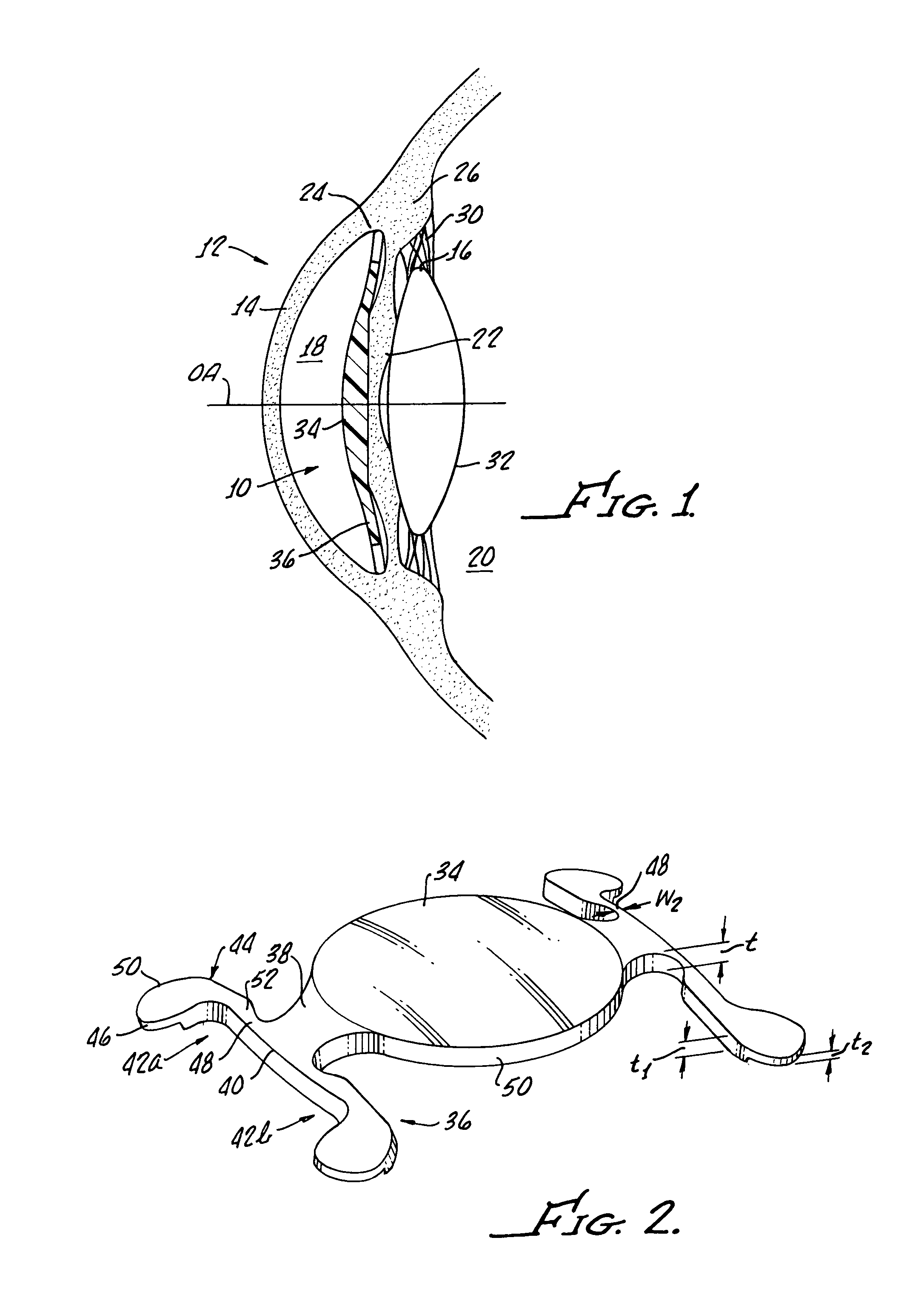 Foldable angle-fixated intraocular lens