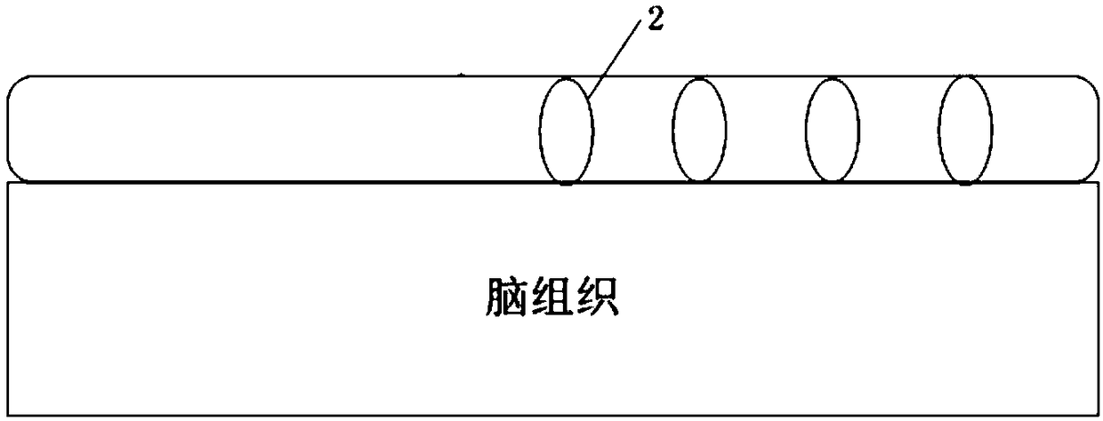 Impedance measuring device and method on basis of deep brain stimulator electrodes