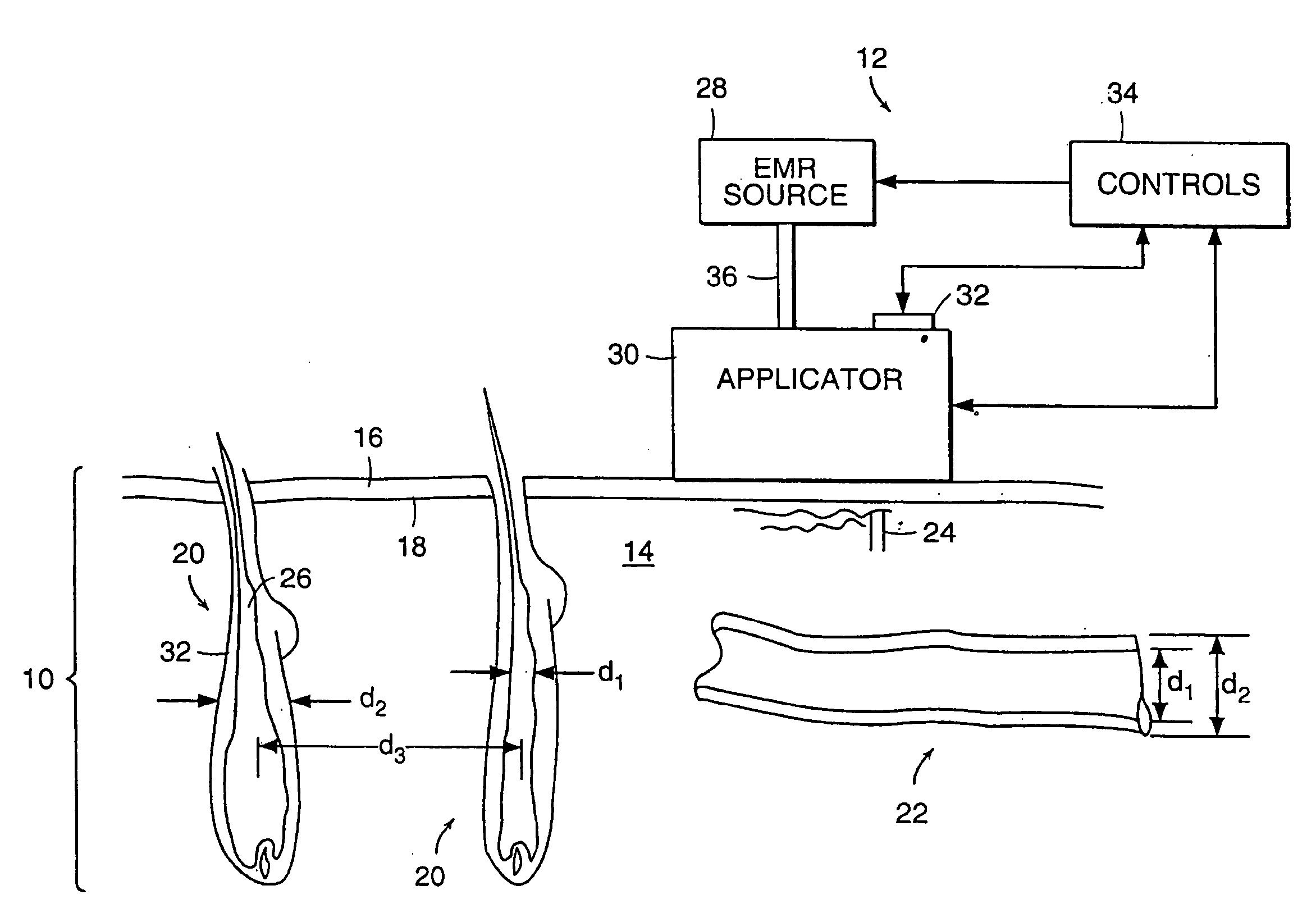 Method and Apparatus for Medical Treatment Utilizing Long Duration Electromagnetic Radiation