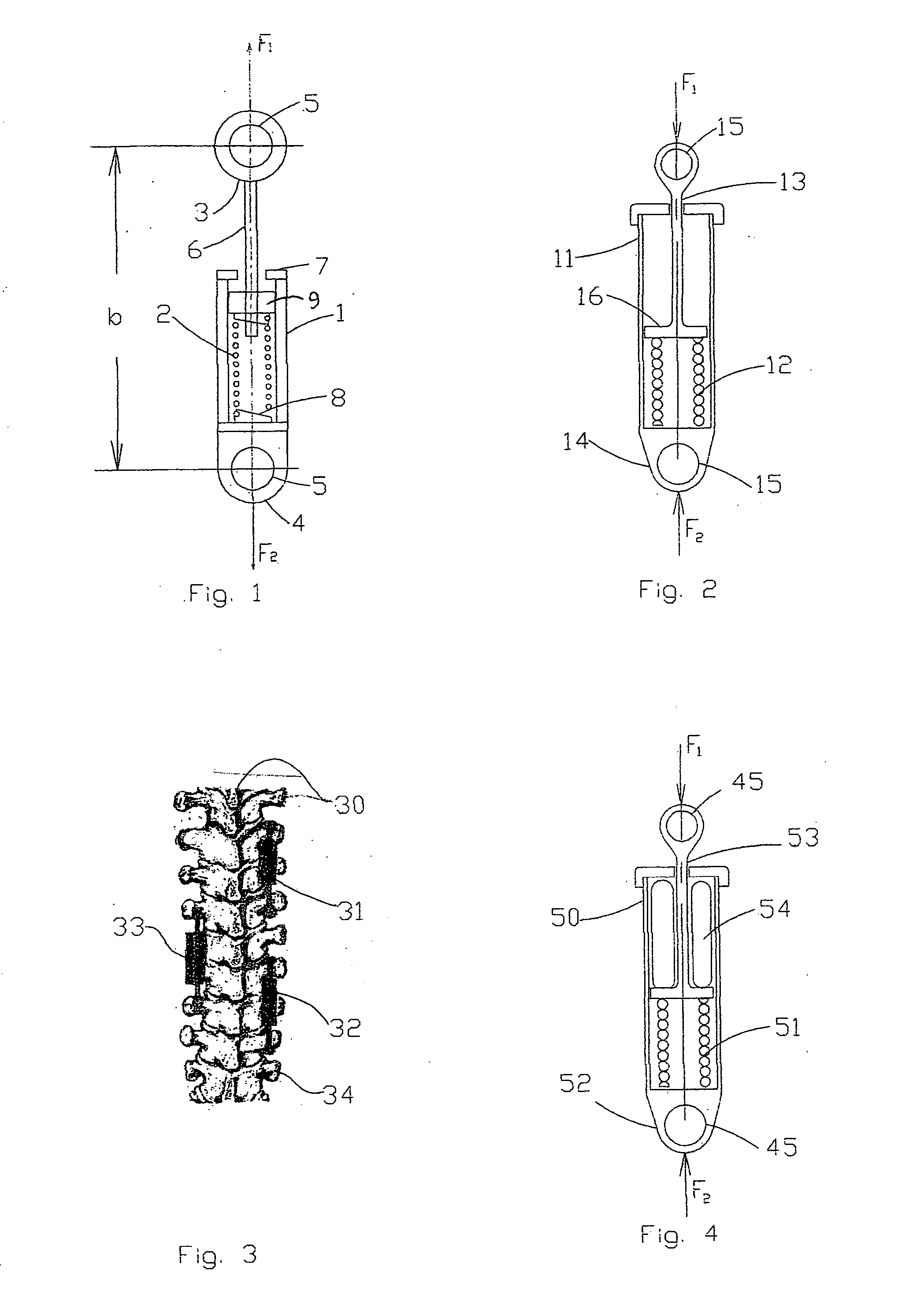 Device for providing a combination of flexibility and variable force to the spinal column for the treatment of scoliosis