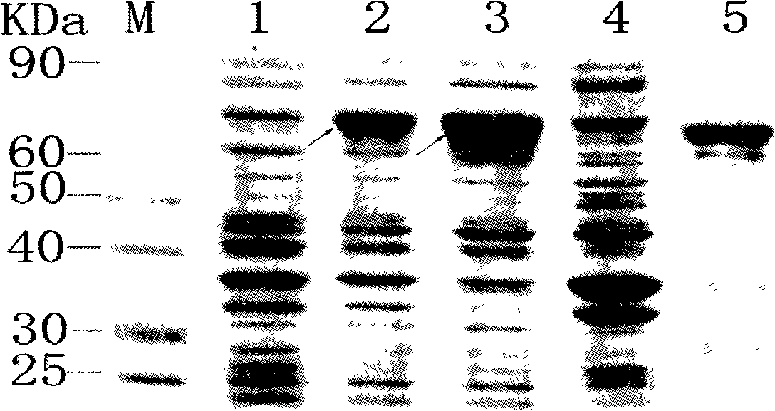 Polypeptide vaccine for resisting multiple hypotype avian influenza viruses and preparation method thereof