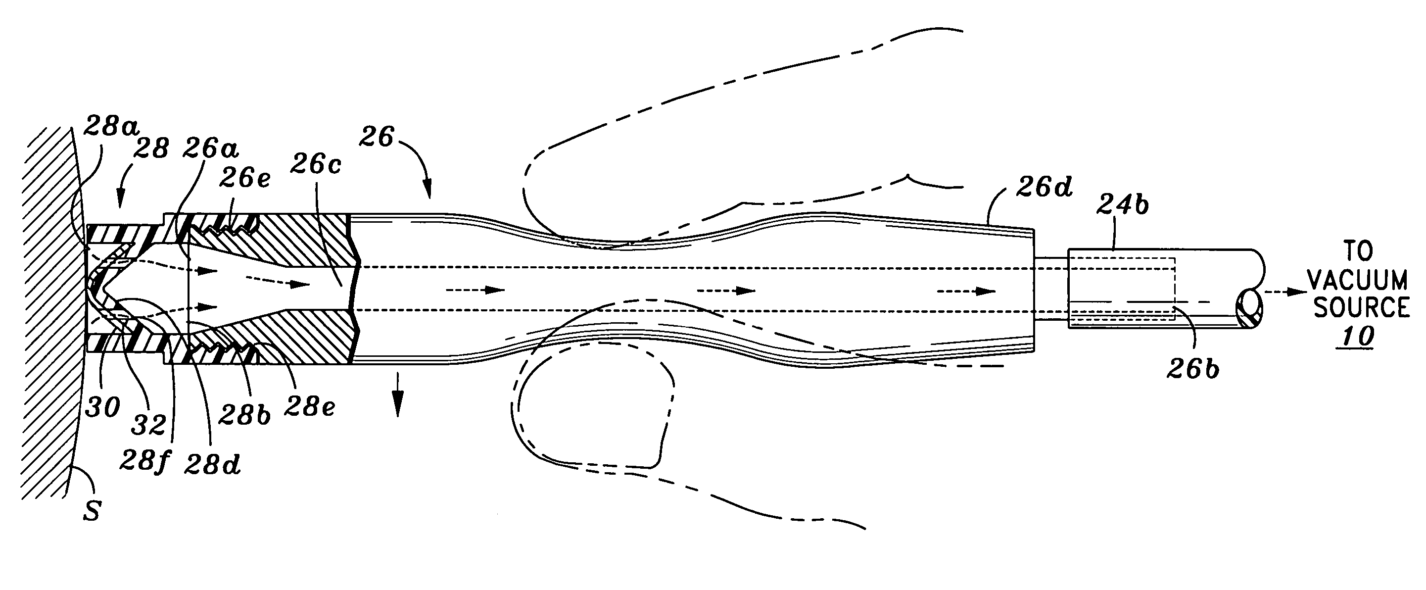 Hydro-dermabrasion apparatus and method of use