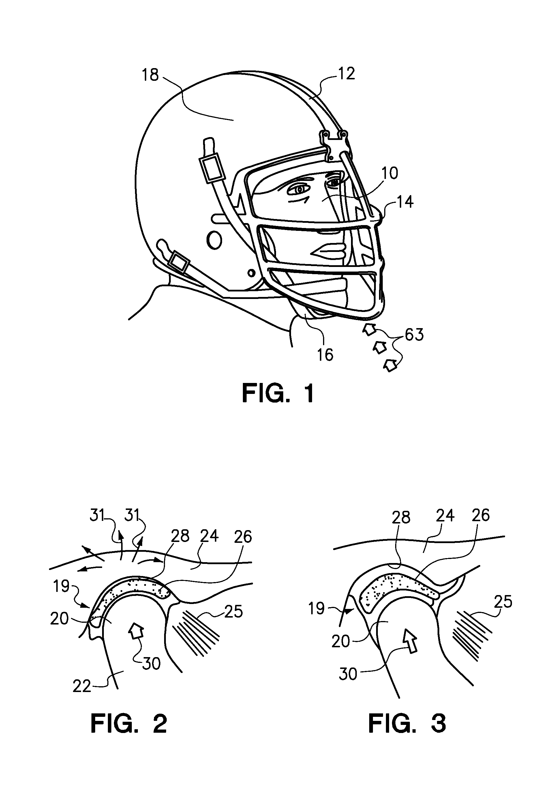 Mouthguard and method of manufacture therefor