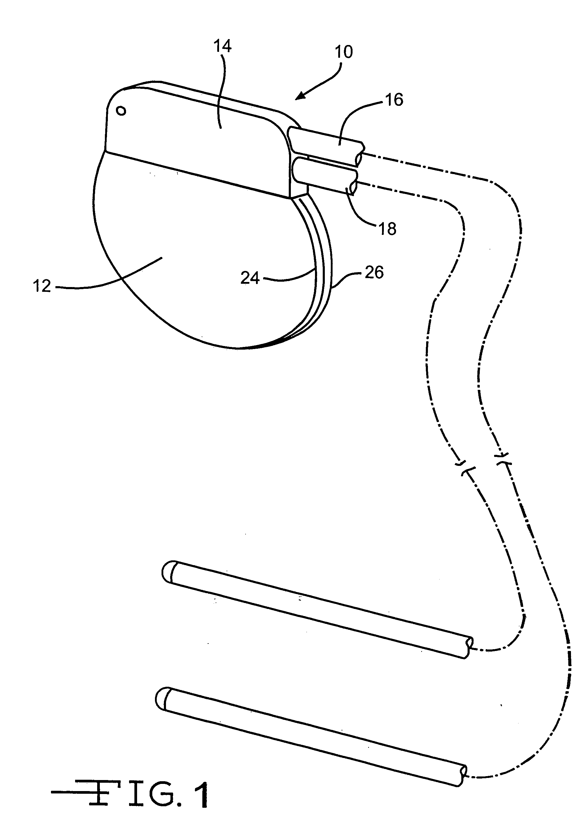 Implantable electrical lead wire