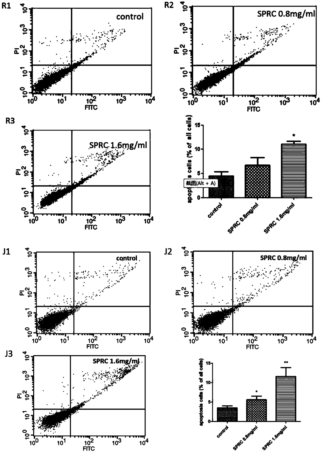 Application of S-propargyl-cysteine to preparation of medicines for treating blood disease system tumors