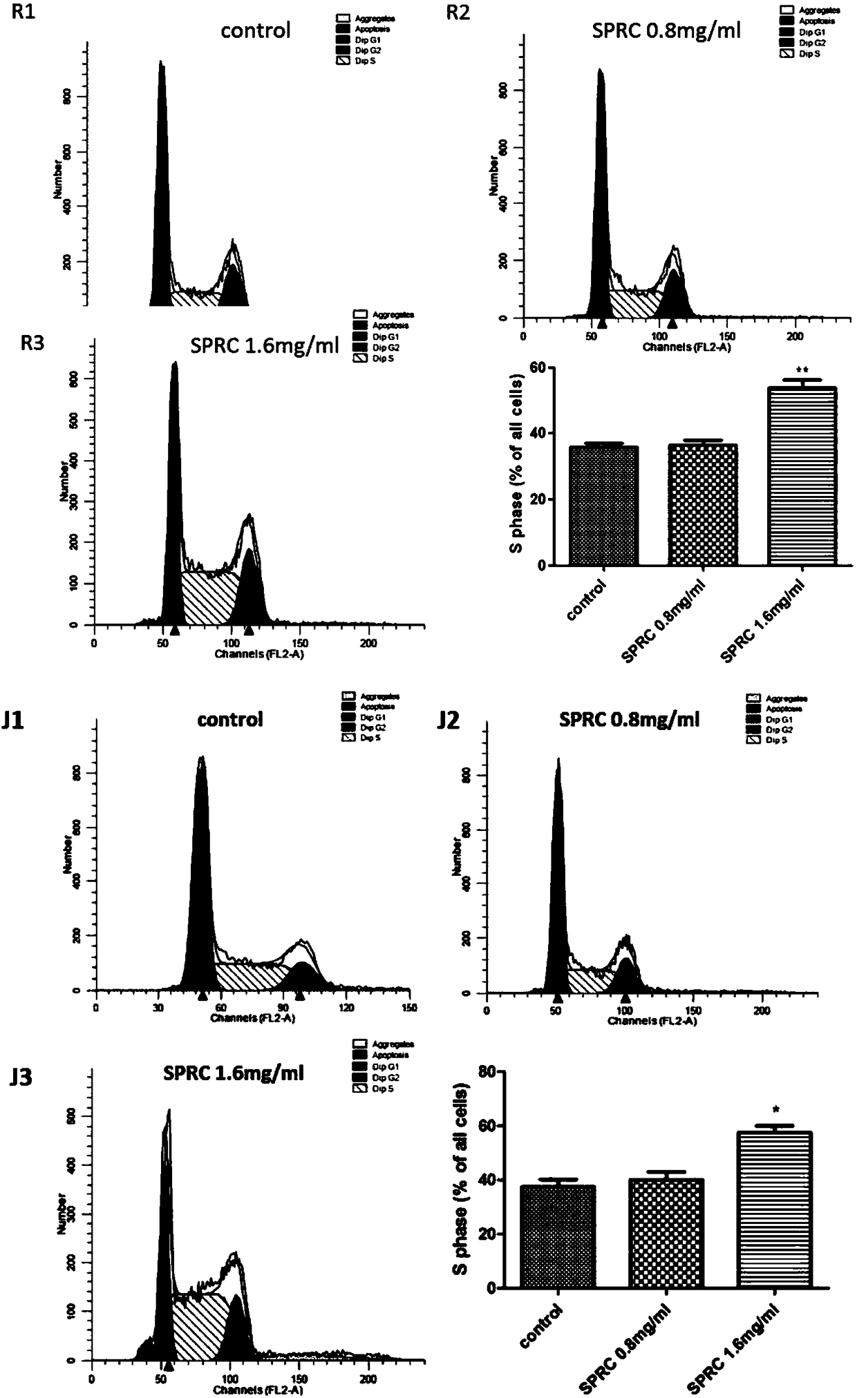 Application of S-propargyl-cysteine to preparation of medicines for treating blood disease system tumors